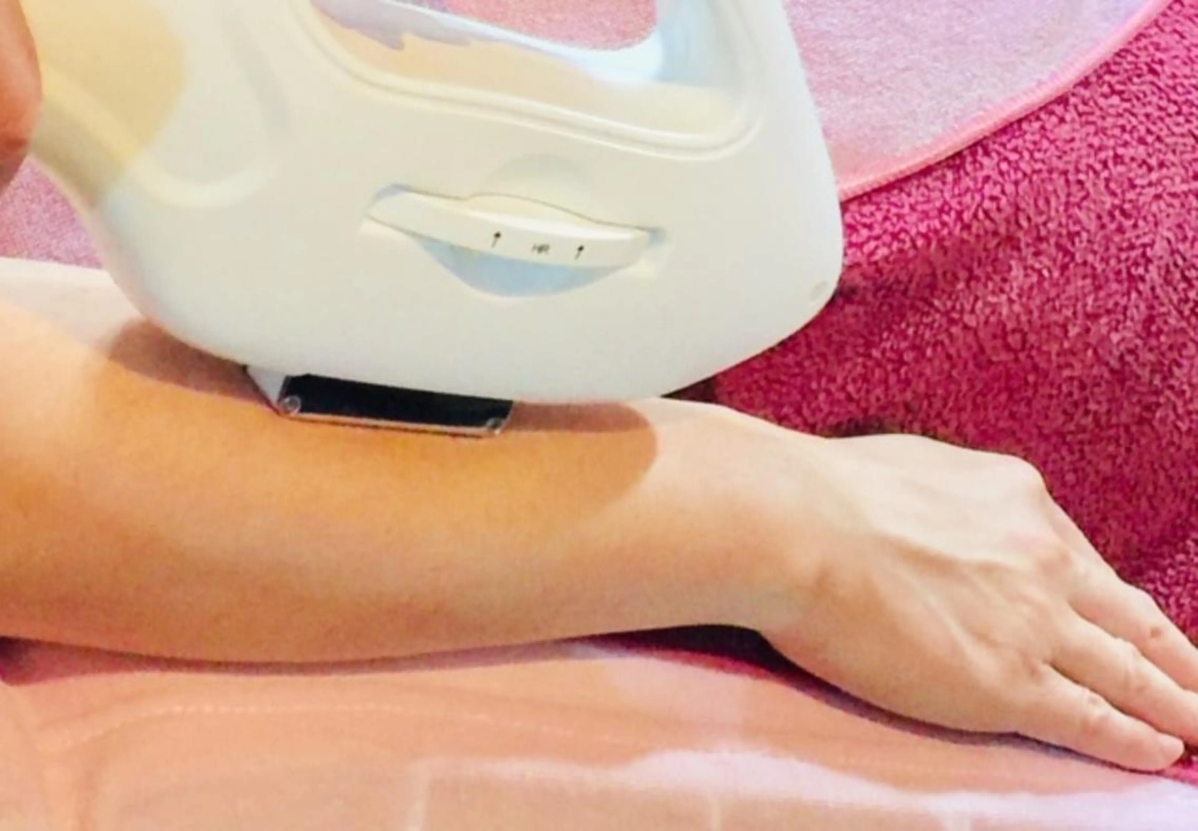 【わき＆うで全体脱毛 6点】　わき×うで全体×甲・指の写真