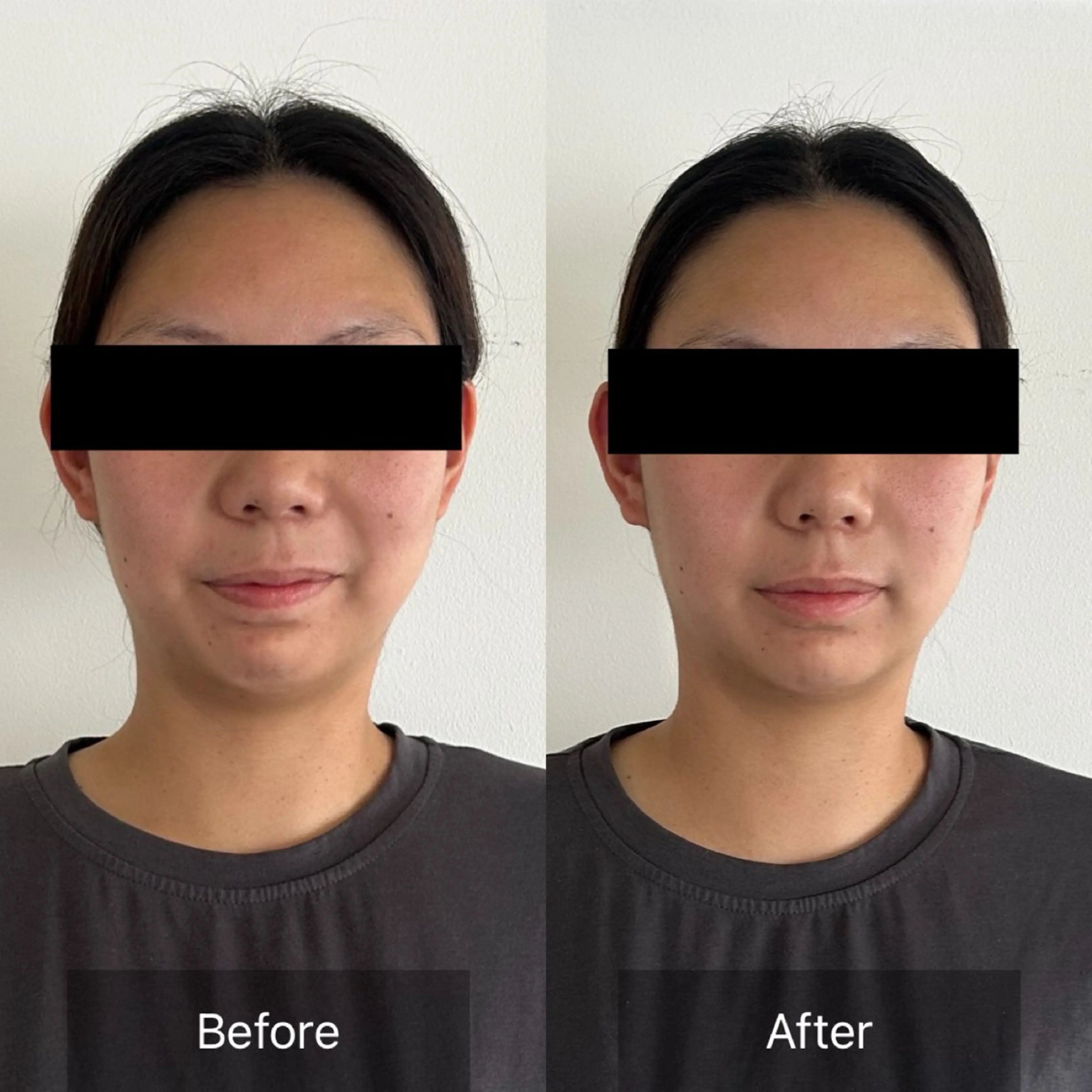 Radiance H.Oのエステ・リラクイメージ