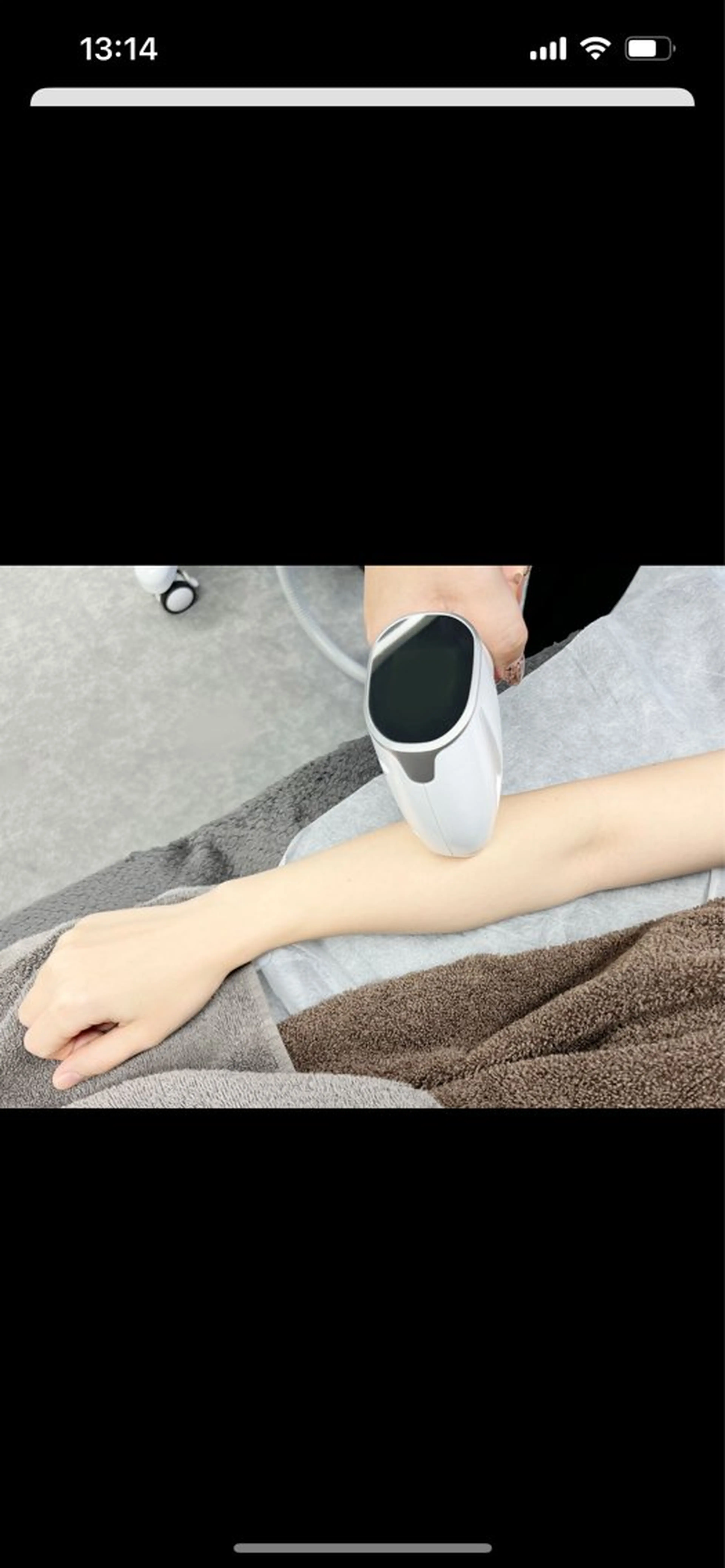 最新【スピード美肌全身脱毛】VIO込み1回コースの写真