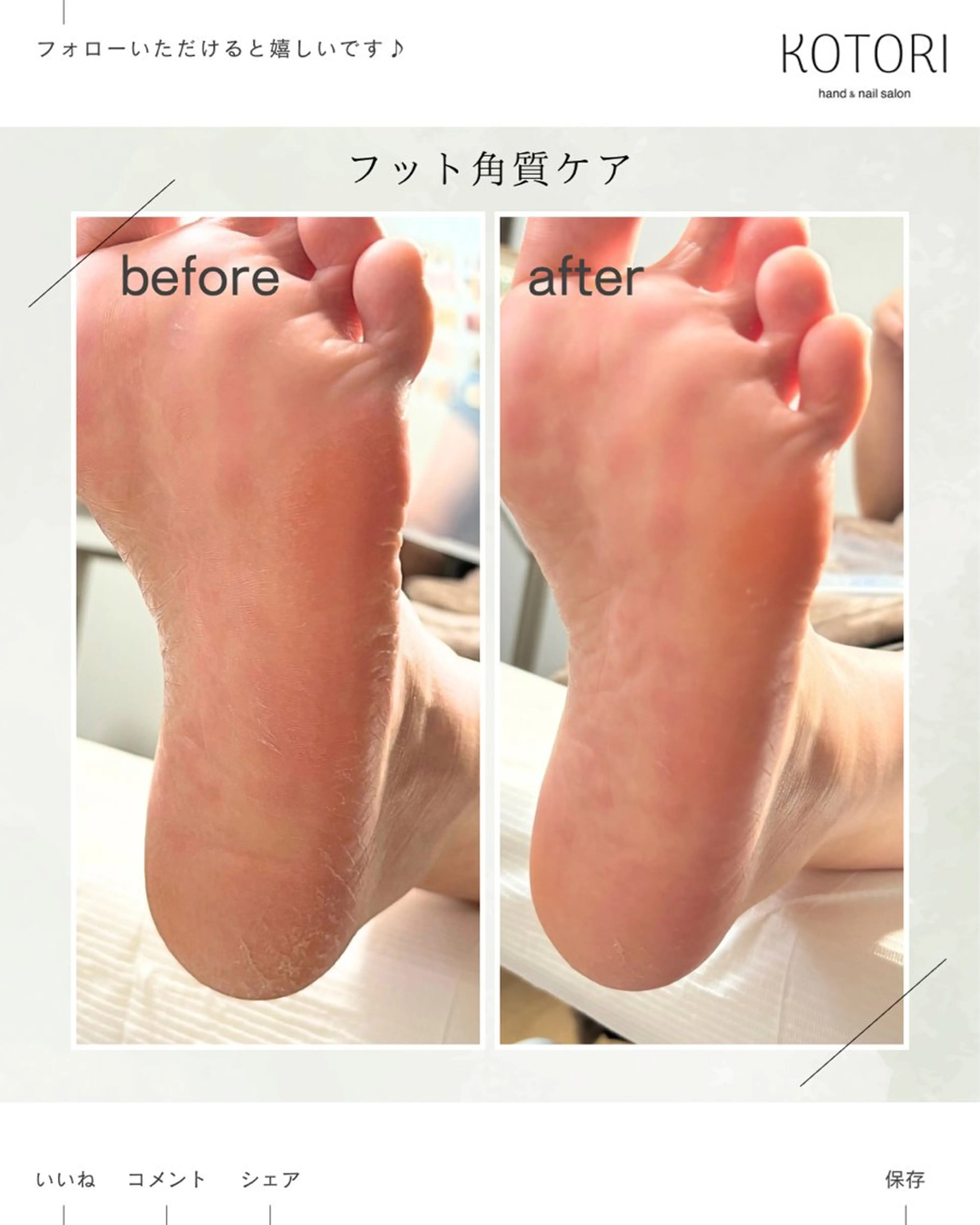 KOTORI ことりのネイルデザイン