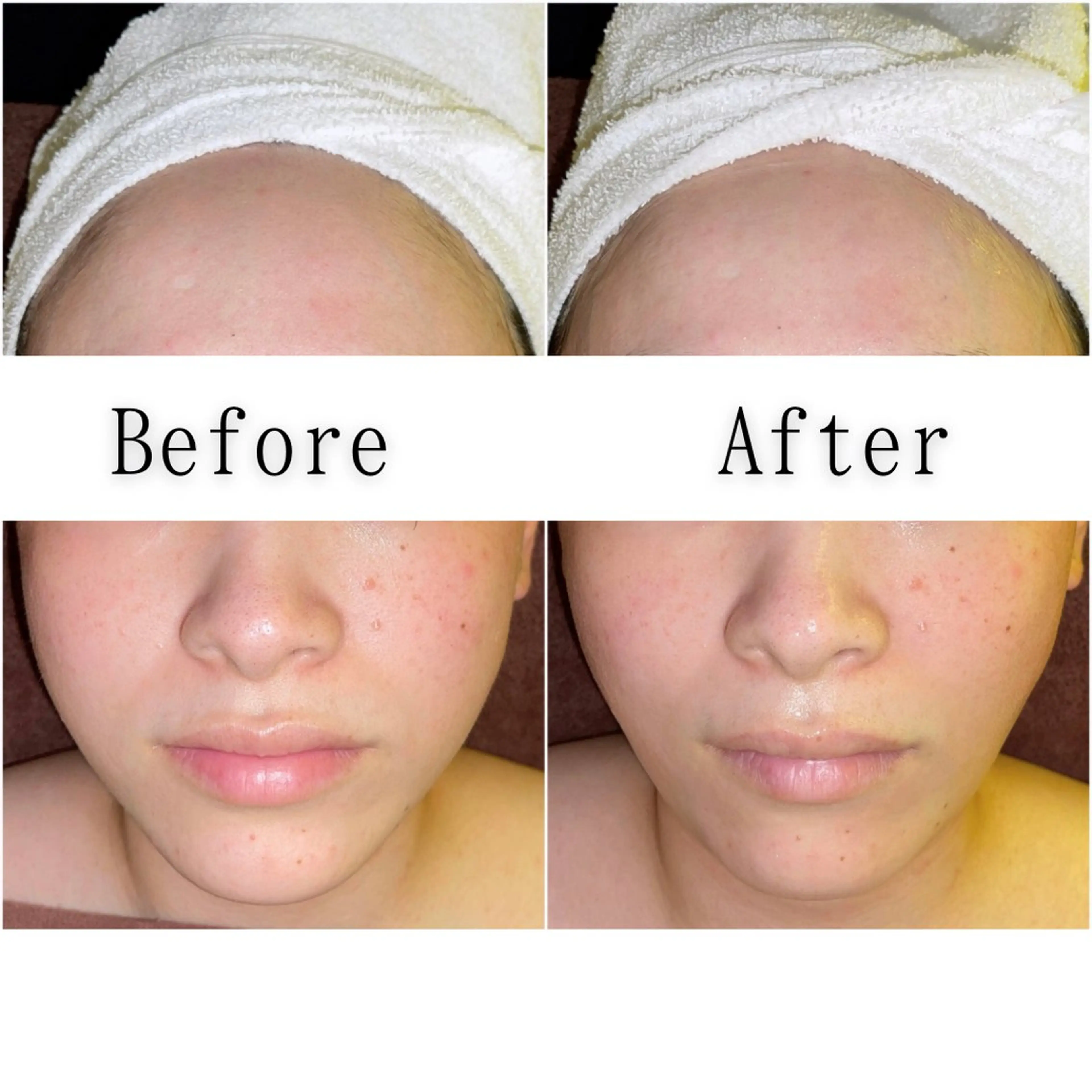 エステ SELF  BEAUTY gracia浦添店所属・gracia 浦添店のその他イメージ