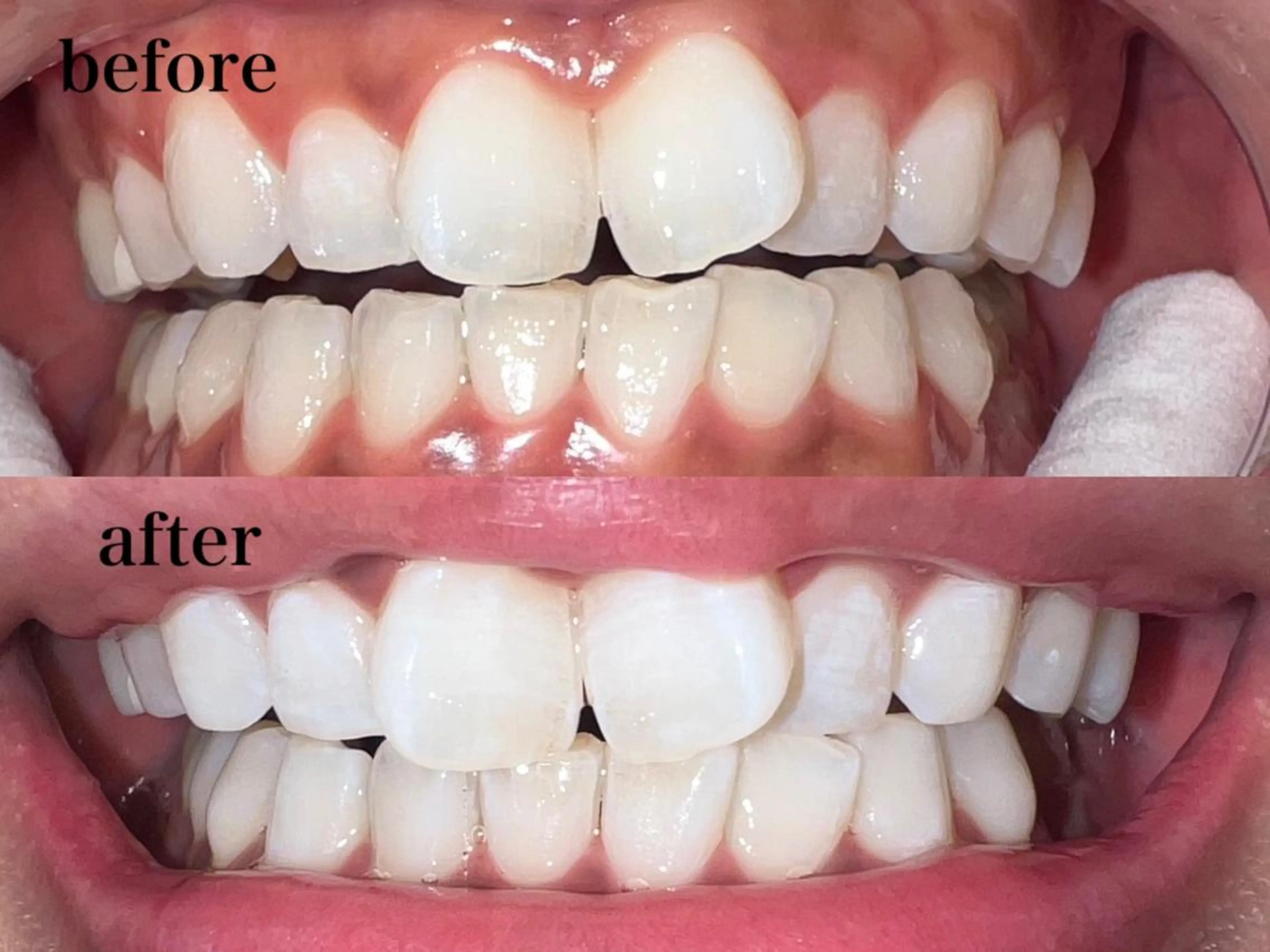 その他 Bébé×DiDiA 野々市市役所前店のエステ・リラクイメージ