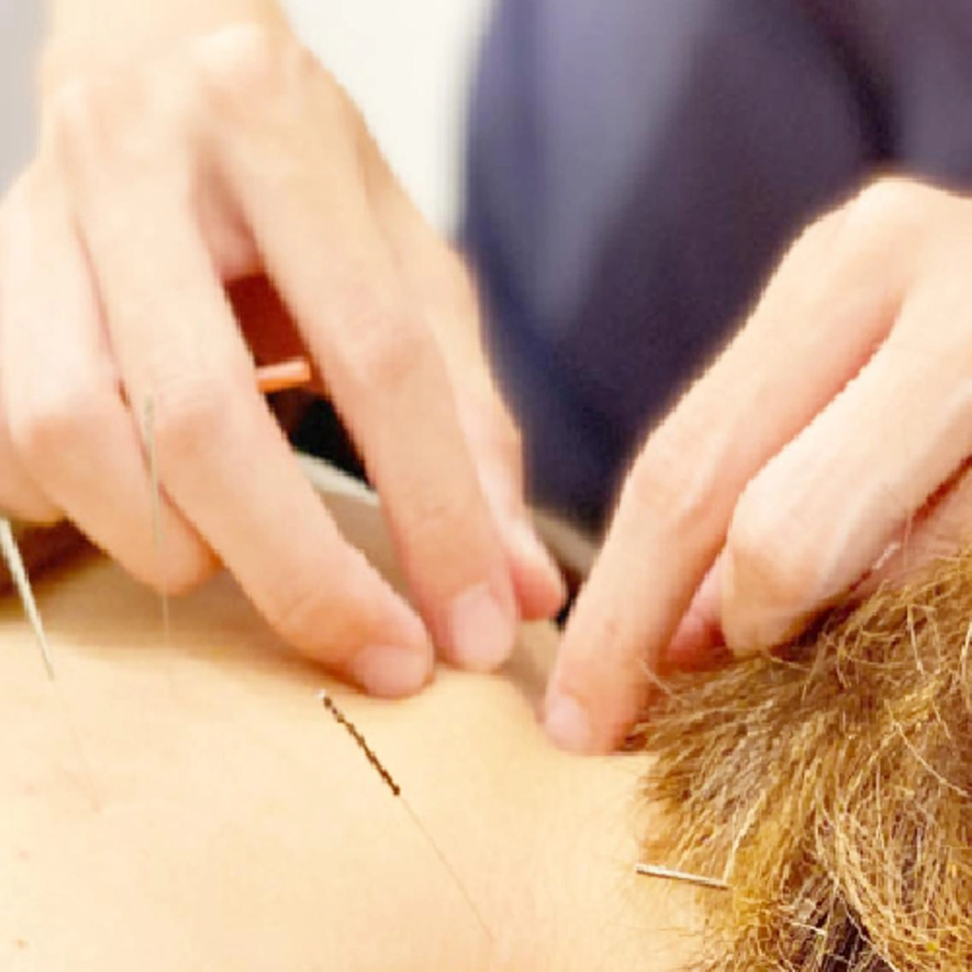 エステ リラク 🌈 肌質改善 🙌 美容鍼 ヒロキ🌈のエステ・リラクイメージ