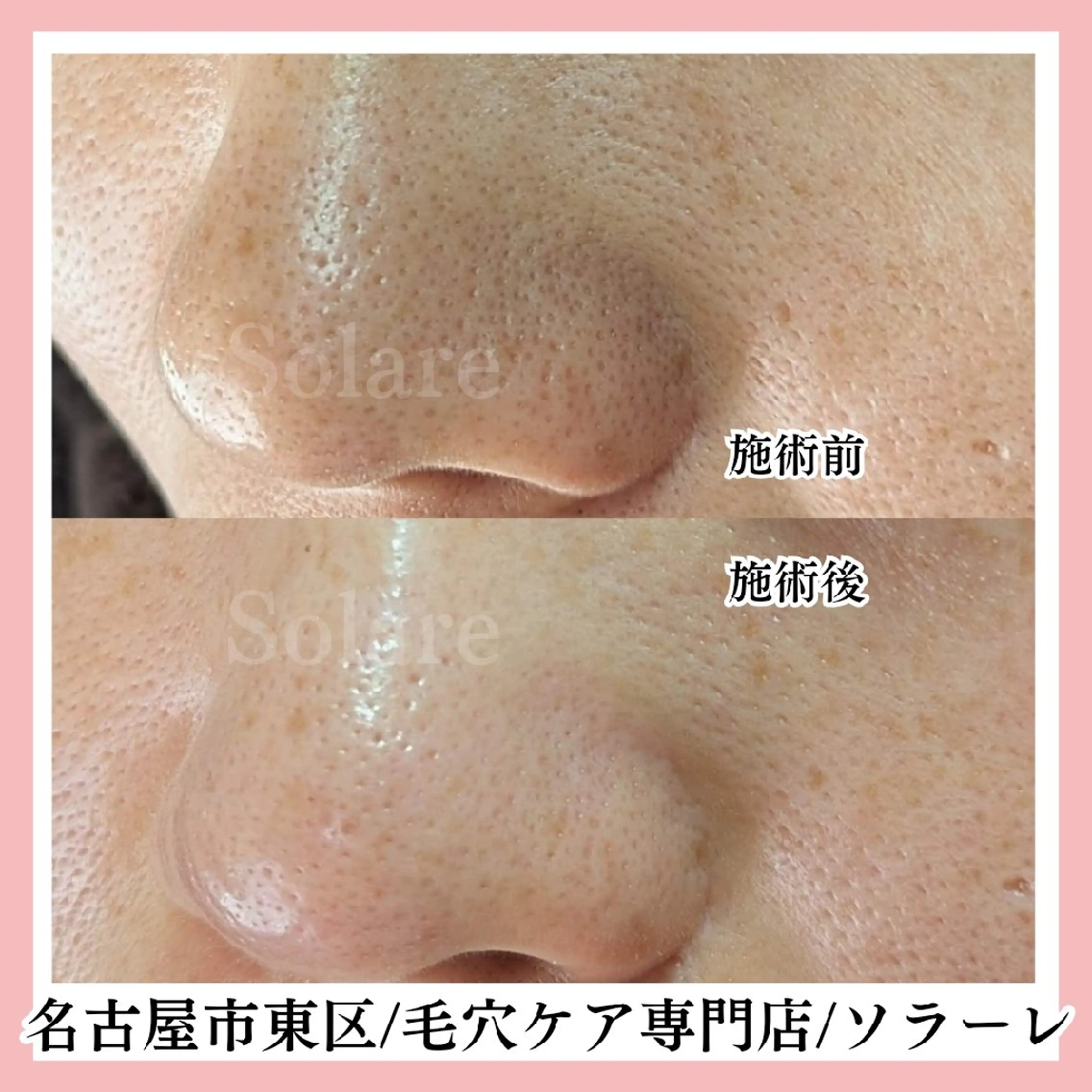  毛穴洗浄・まつ毛 の専門店 ソラーレのエステ・リラクイメージ