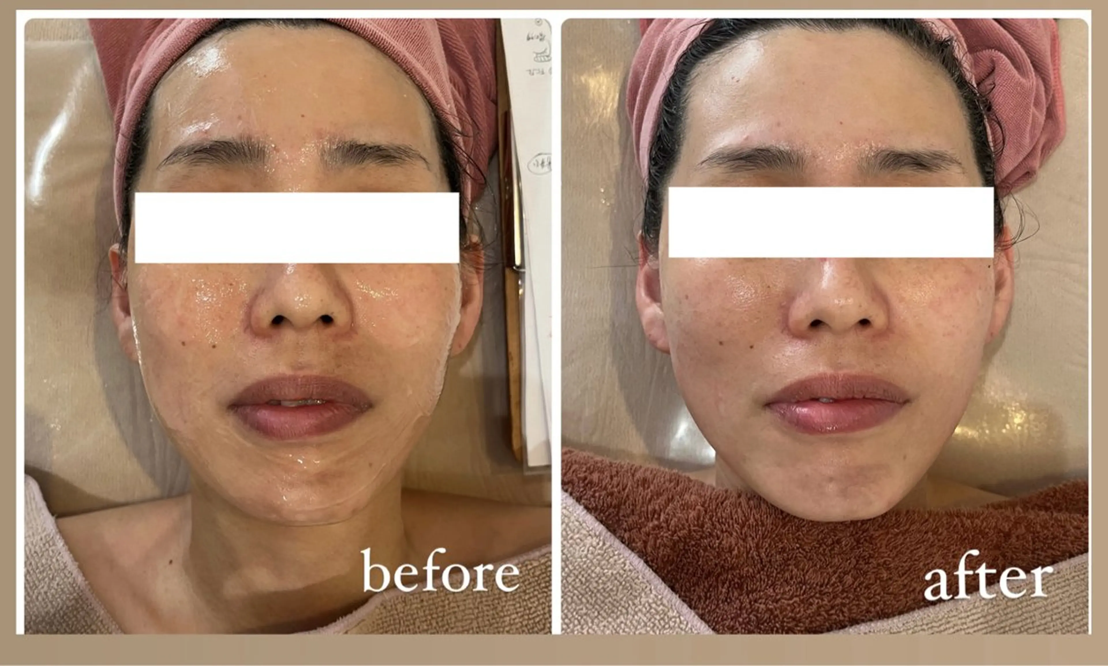 エステ RAY Beauty エステ　一宮店のエステ・リラクイメージ