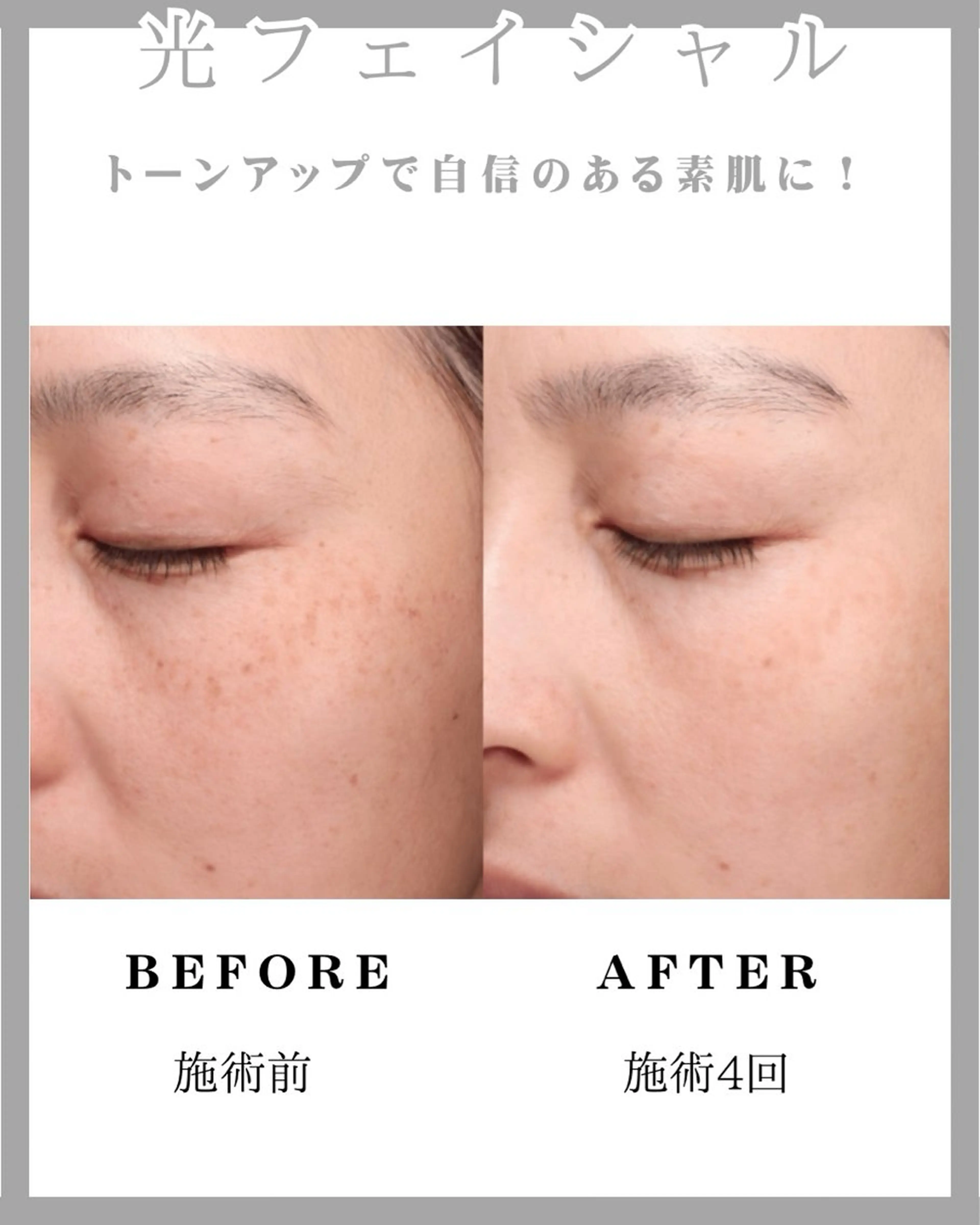 SHINE💫 山口のその他イメージ