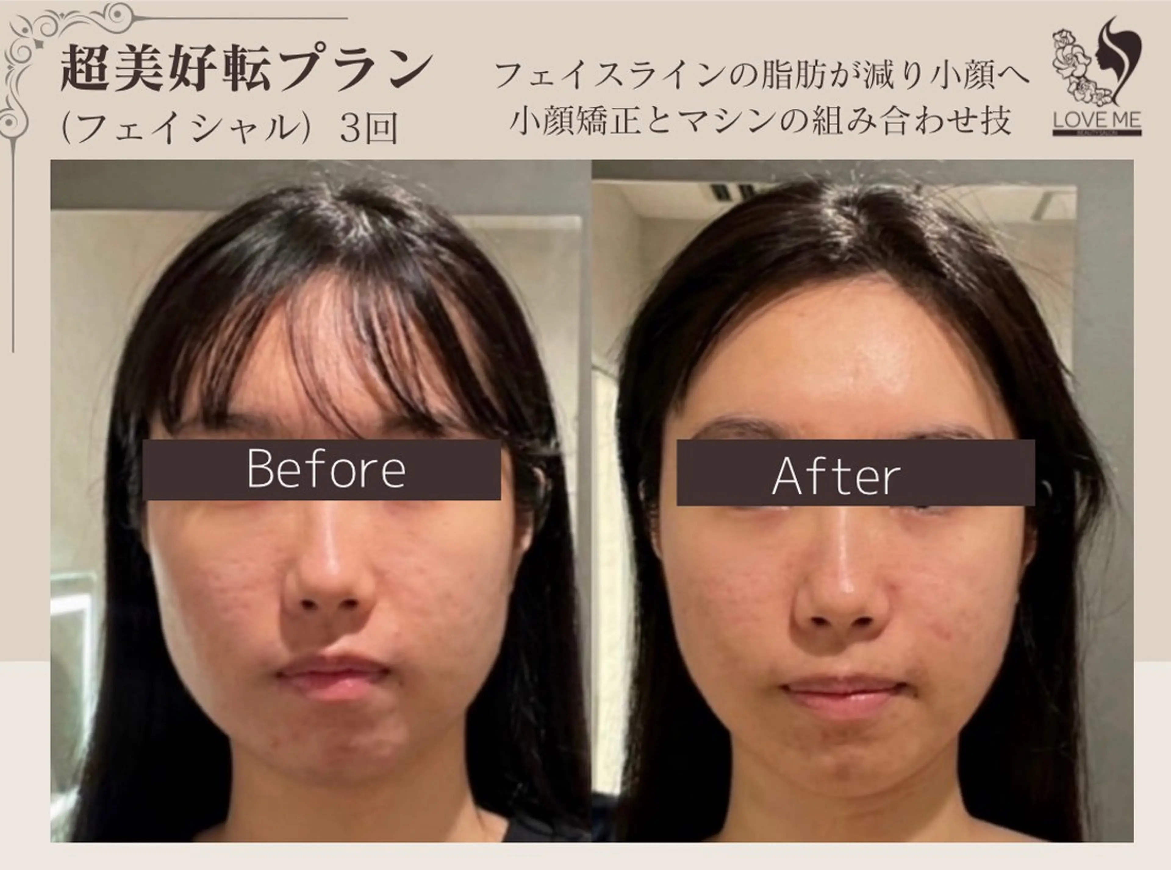 エステ 総合美容サロン LOVEME渋谷本店のエステ・リラクイメージ