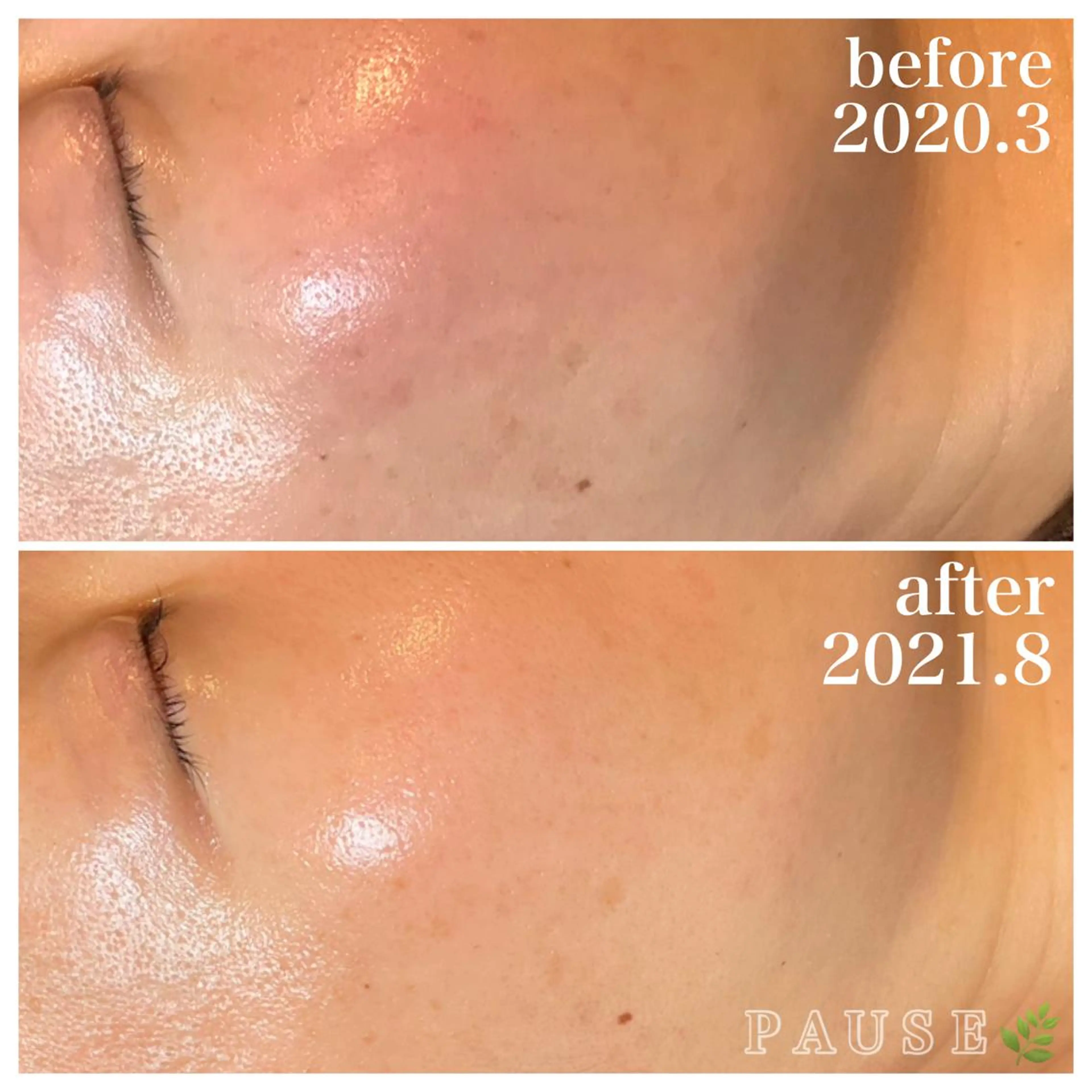 エステ 浜野 恵美のエステ・リラクイメージ