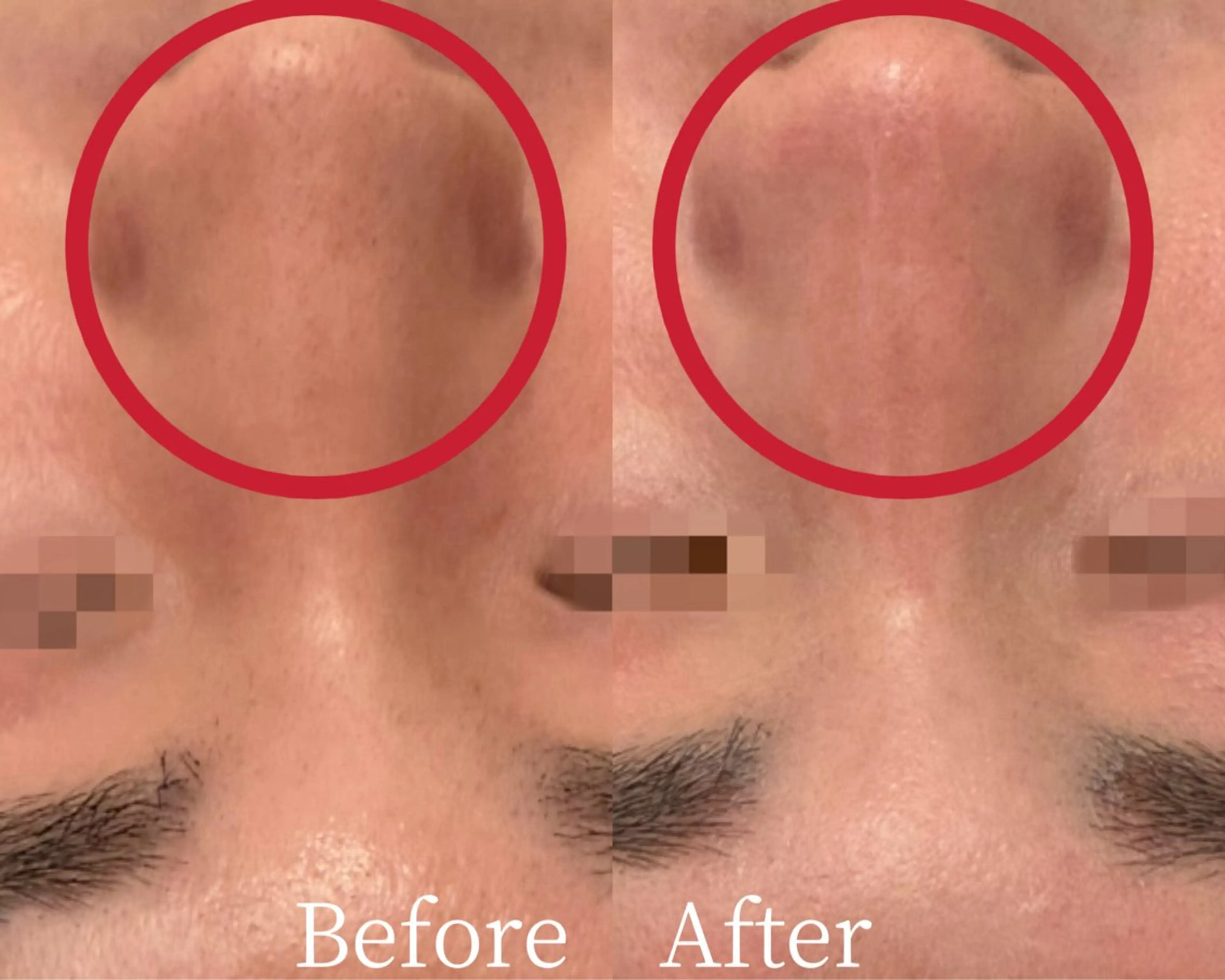 エステ リラク Ginza Charerのエステ・リラクイメージ