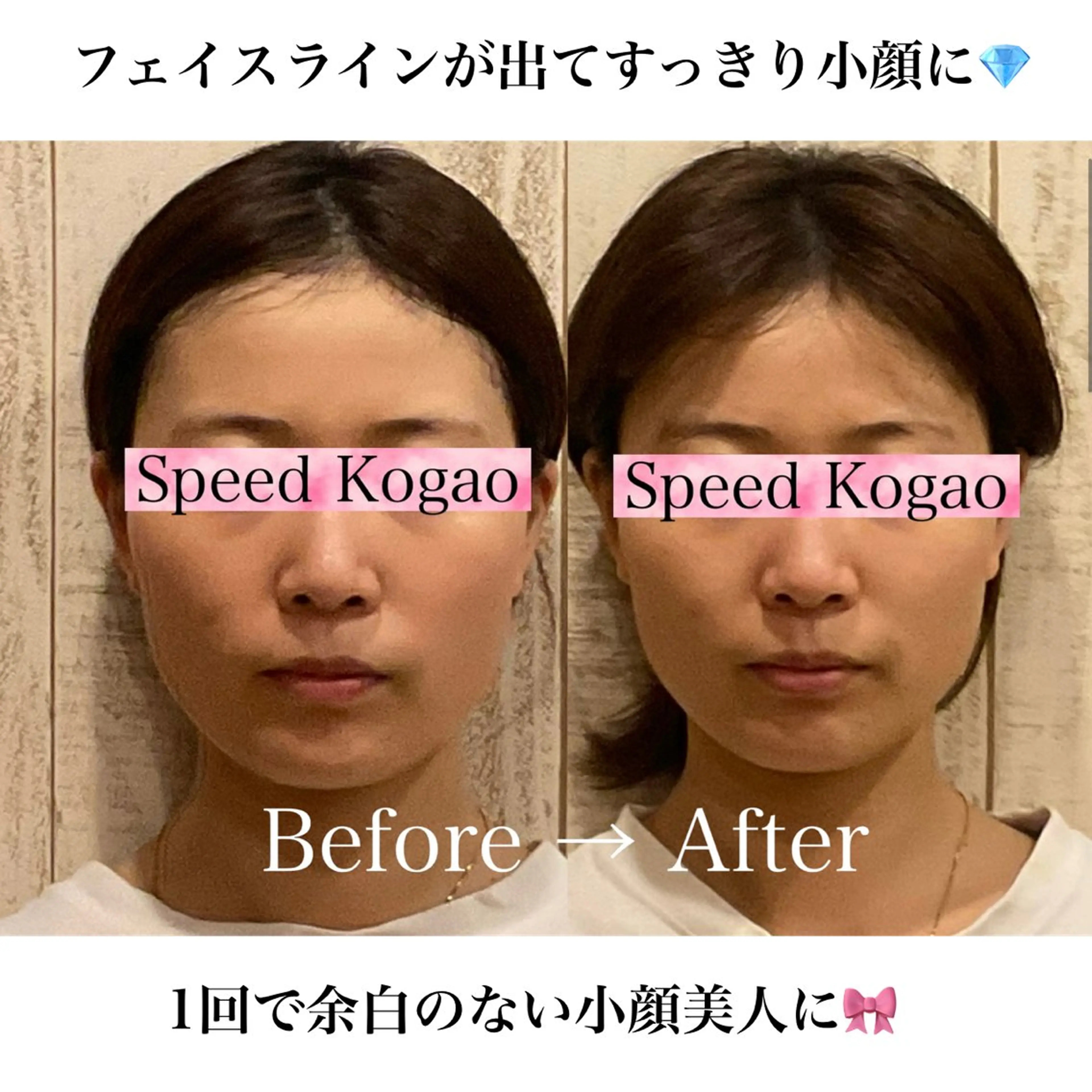 エステ リラク 渋谷小顔矯正 毛穴洗浄ウミのエステ・リラクイメージ