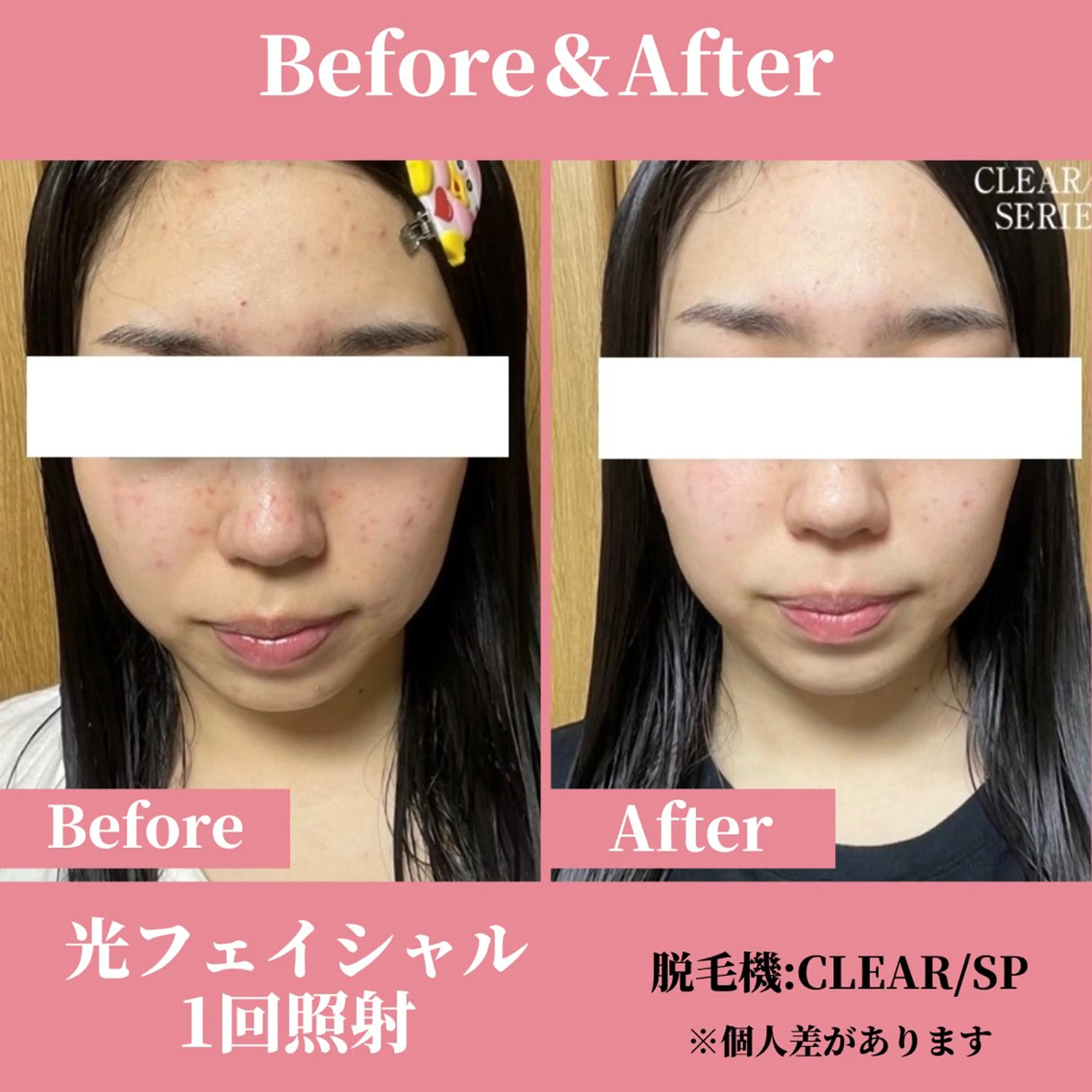 有人型セルフサロン 脱毛／痩身／美顔のその他イメージ