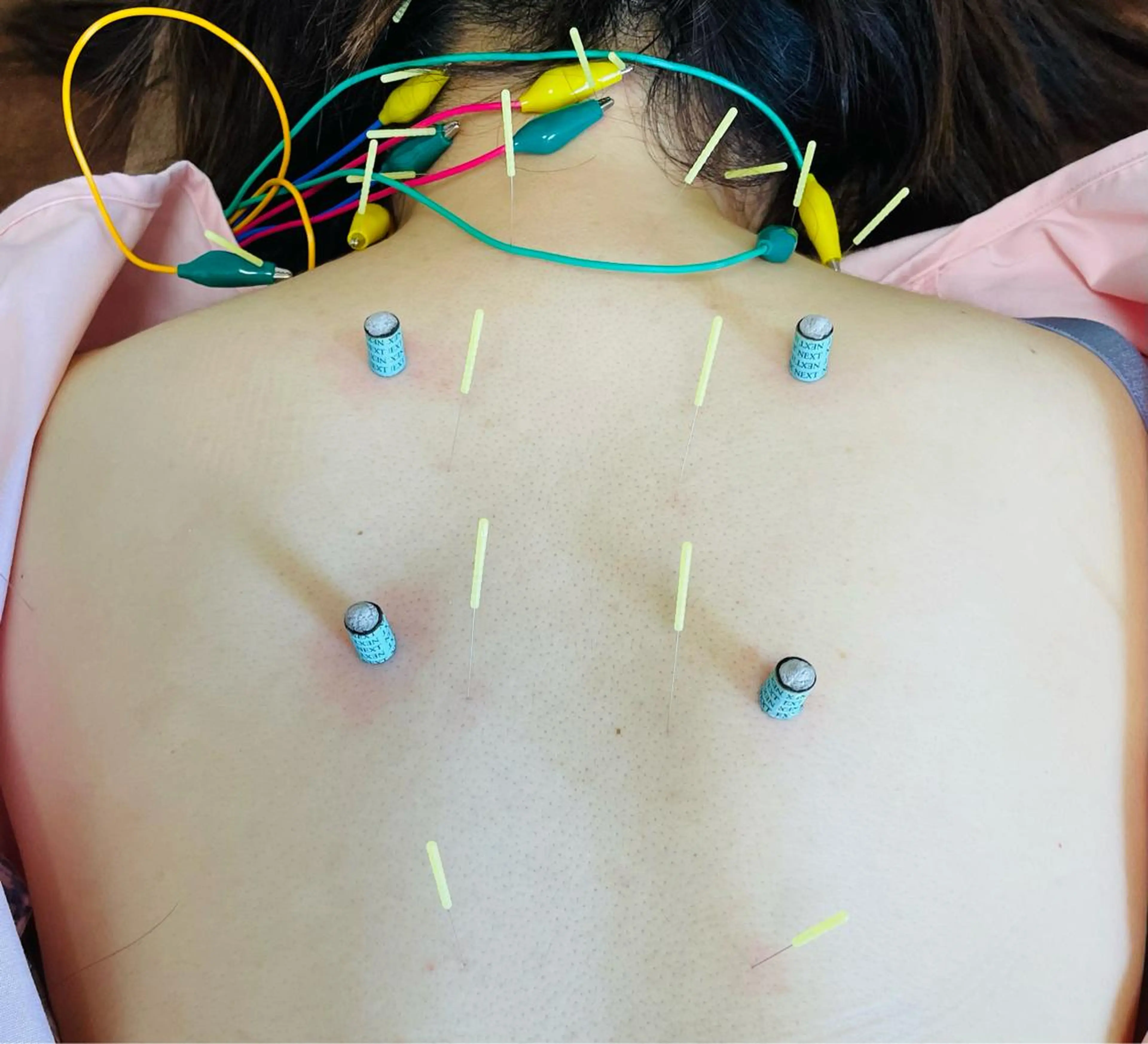 エステ リラク 美容鍼灸サロン mahoroba院長のエステ・リラクイメージ