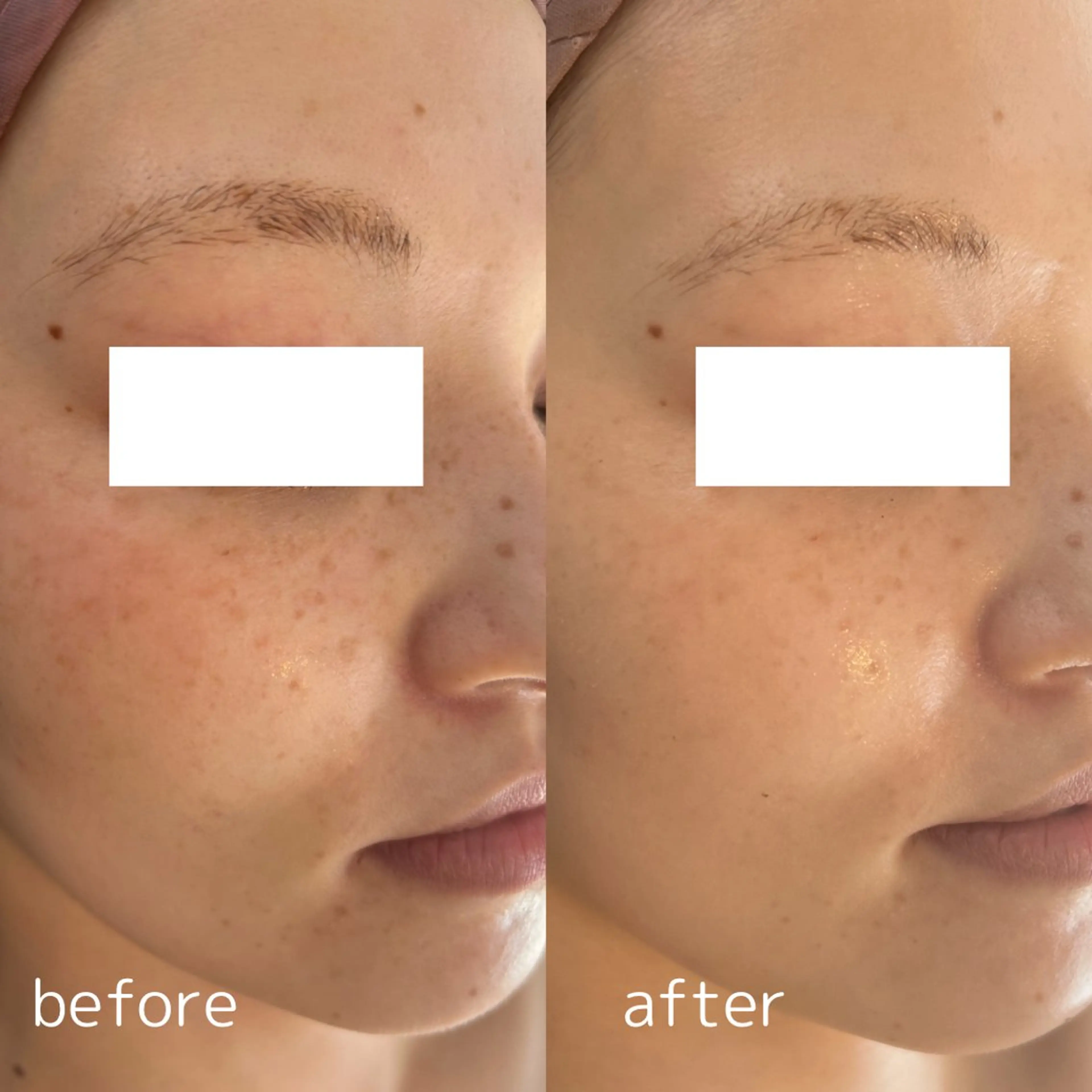 Le cherienのエステ・リラクイメージ