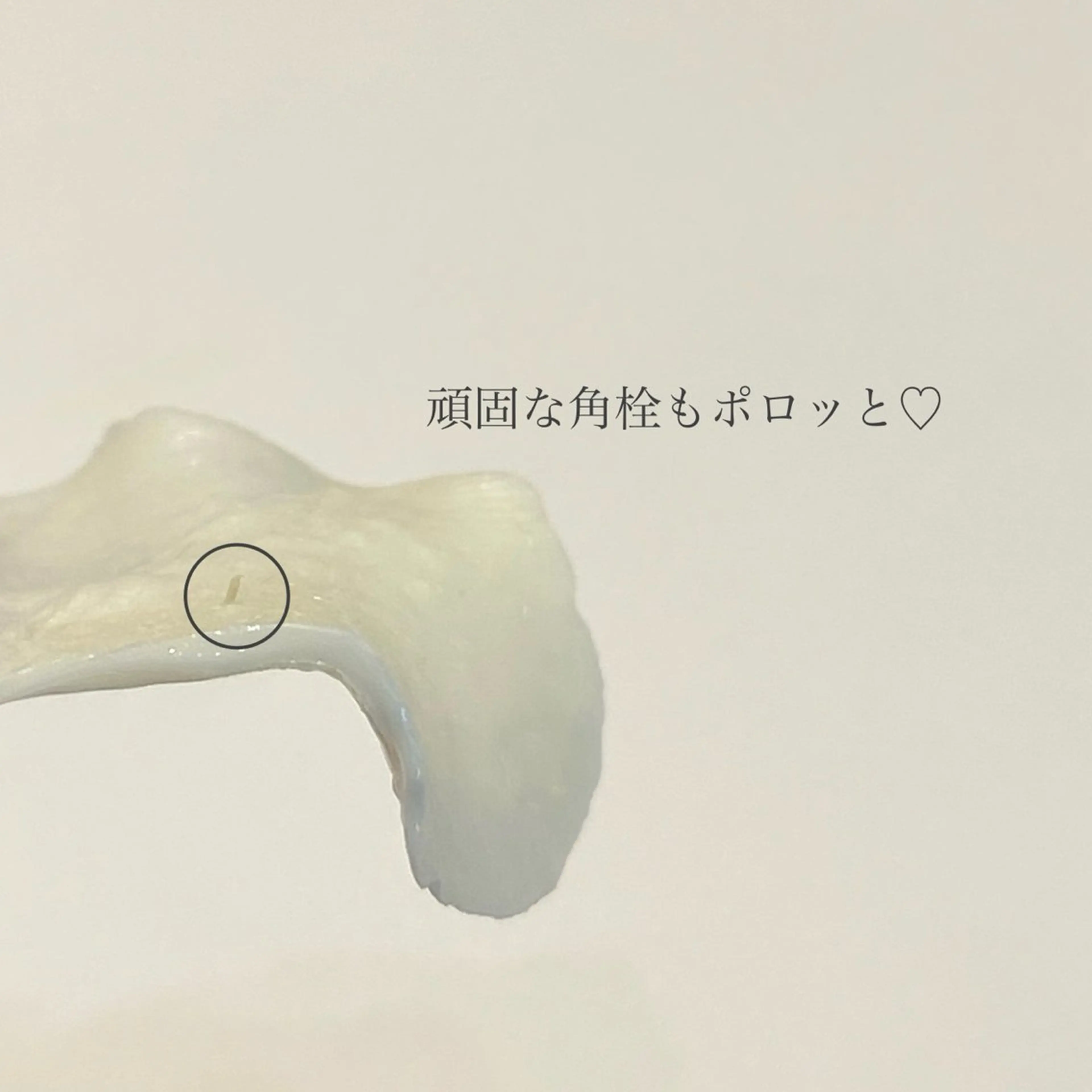 脱毛 &me ayakaのエステ・リラクイメージ