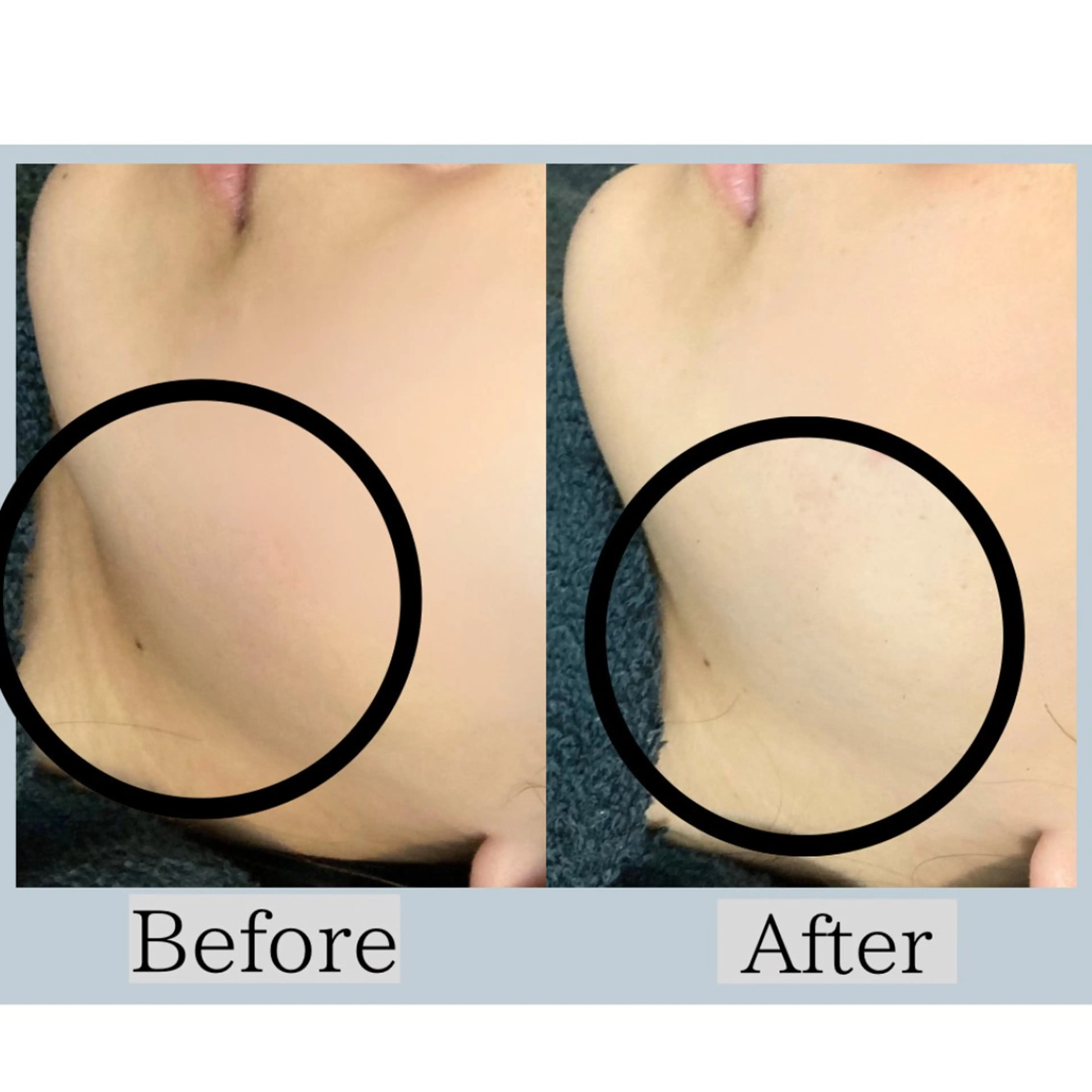 平日限定《小顔フェイシャル60分》美顔器で脂肪までアプローチ🔥 ツヤ肌ピール洗顔→美顔器→白玉美白パック❄️の写真