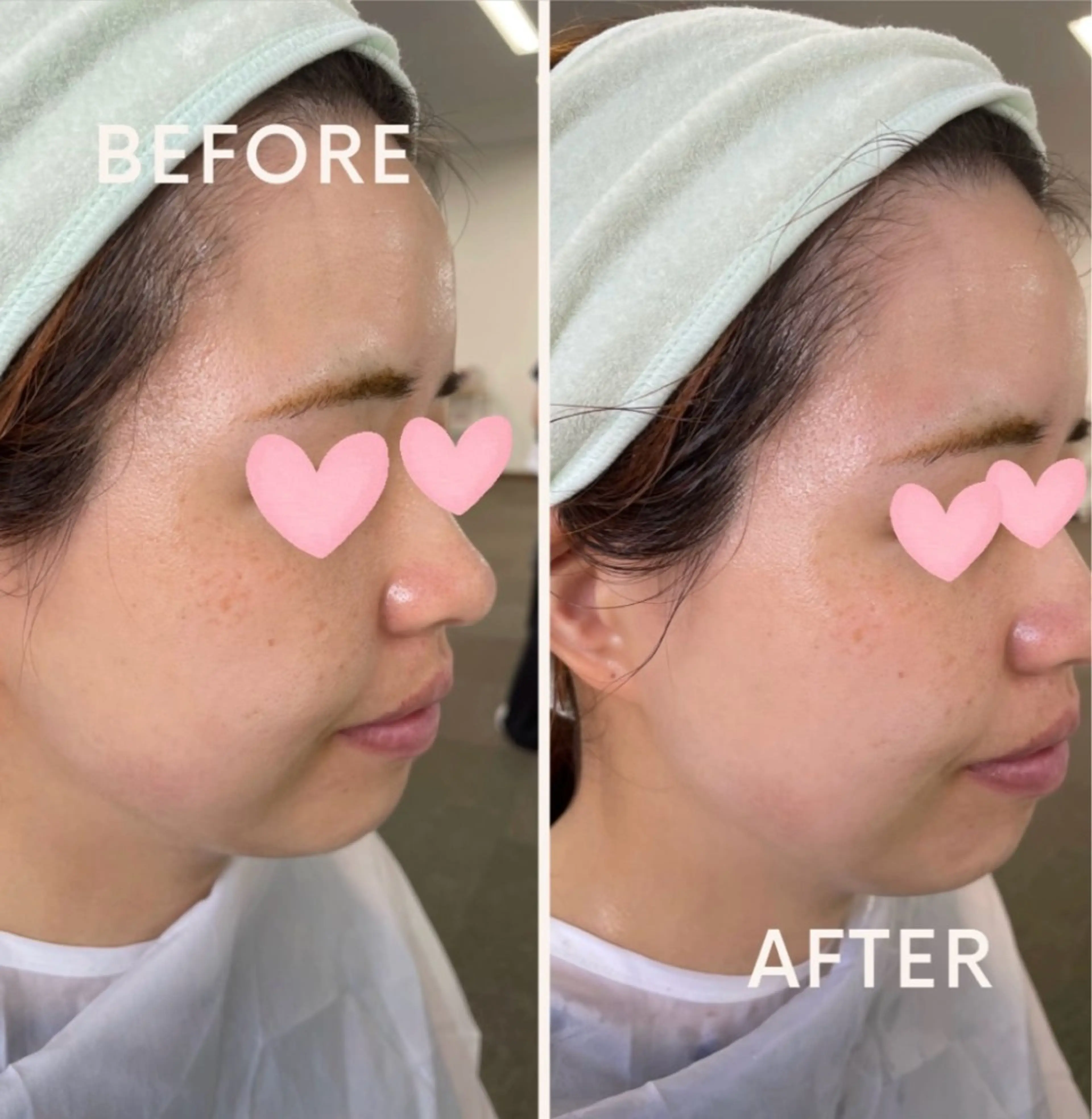 ナリス ビューティステーション デ・アイム 京橋 | De I'm（デ・アイム）| ナリス化粧品所属・金 柚香のエステ・リラクイメージ