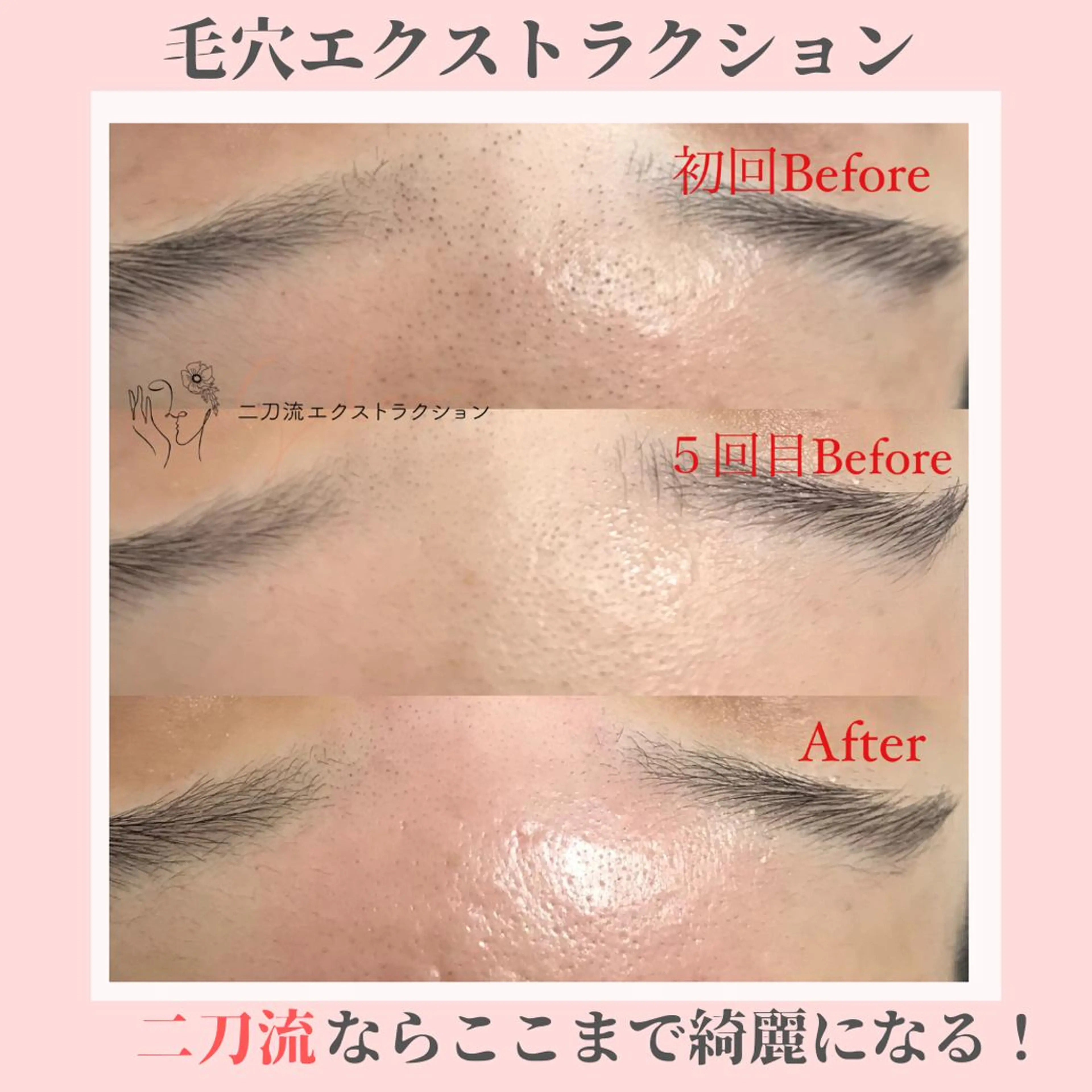 ピーリング専門店 Belluteのエステ・リラクイメージ