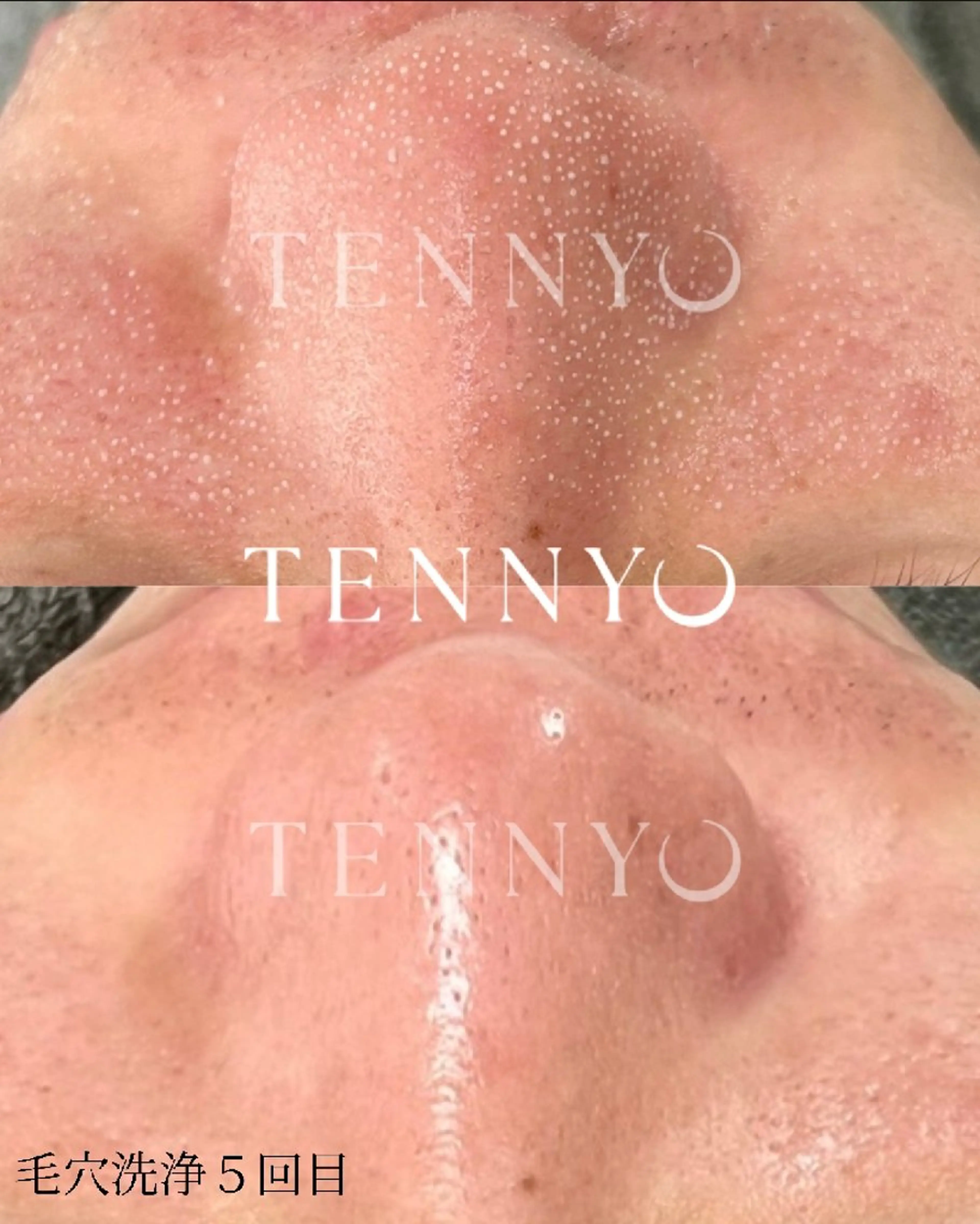 エステ 【クリニック提携】salon de moffyサロンドモフィ所属・【クリニック提携】 サロンドモフィ吉岡のエステ・リラクイメージ