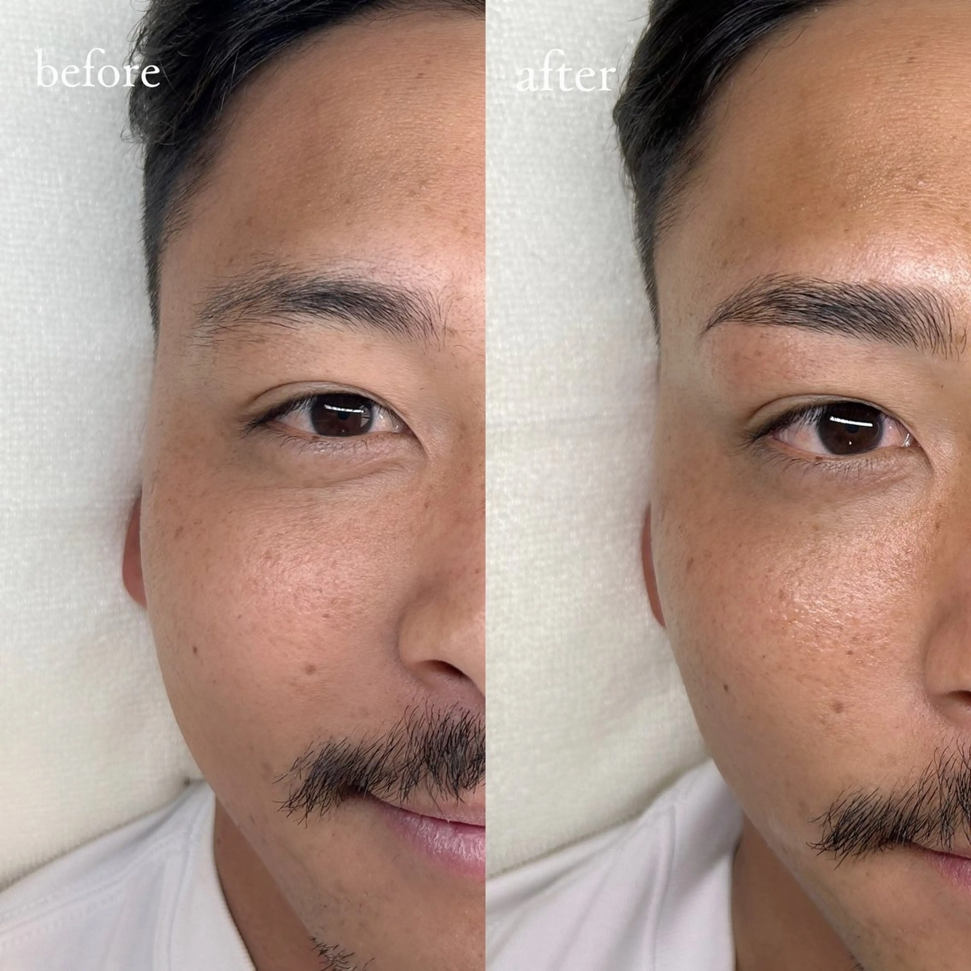 メンズ アイブロウ メンズアイブロウ アイブロウサロンTreat myself所属・Treat myselfの眉毛・アイブロウイメージ