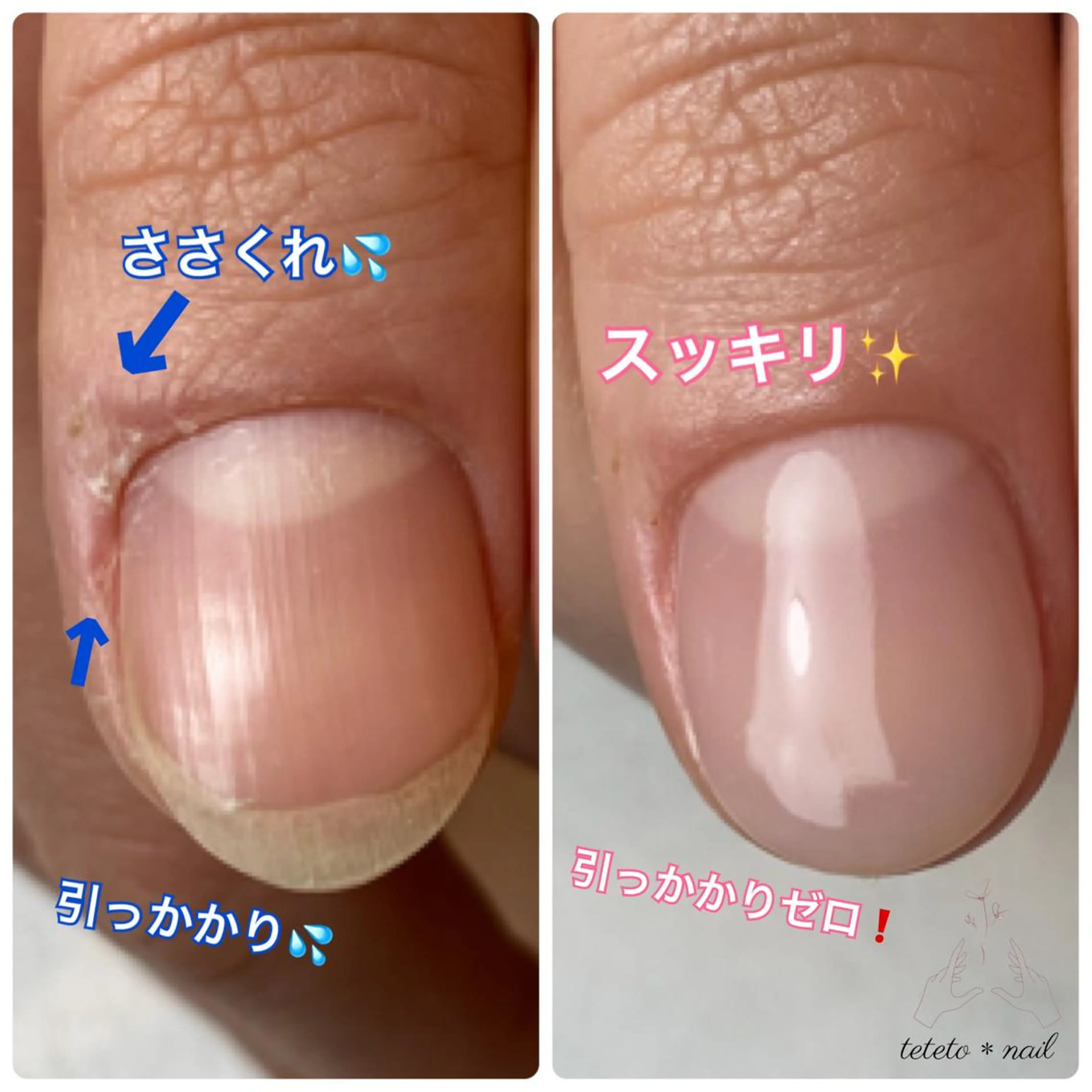 ネイル ハンドネイル teteto＊nail所属・テテト ＊ネイルのネイルデザイン