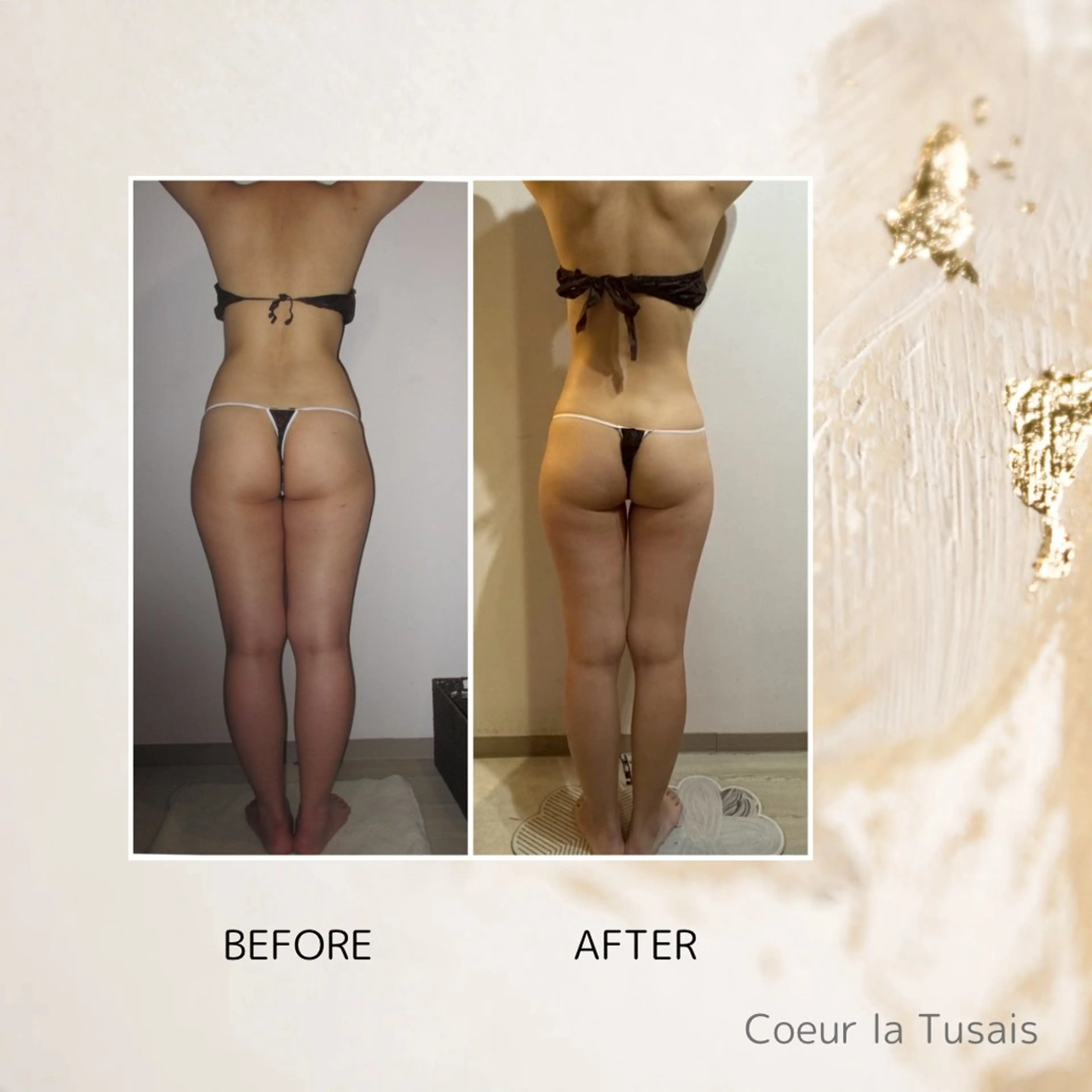 【3回チケット】全身サイズダウンコースの写真