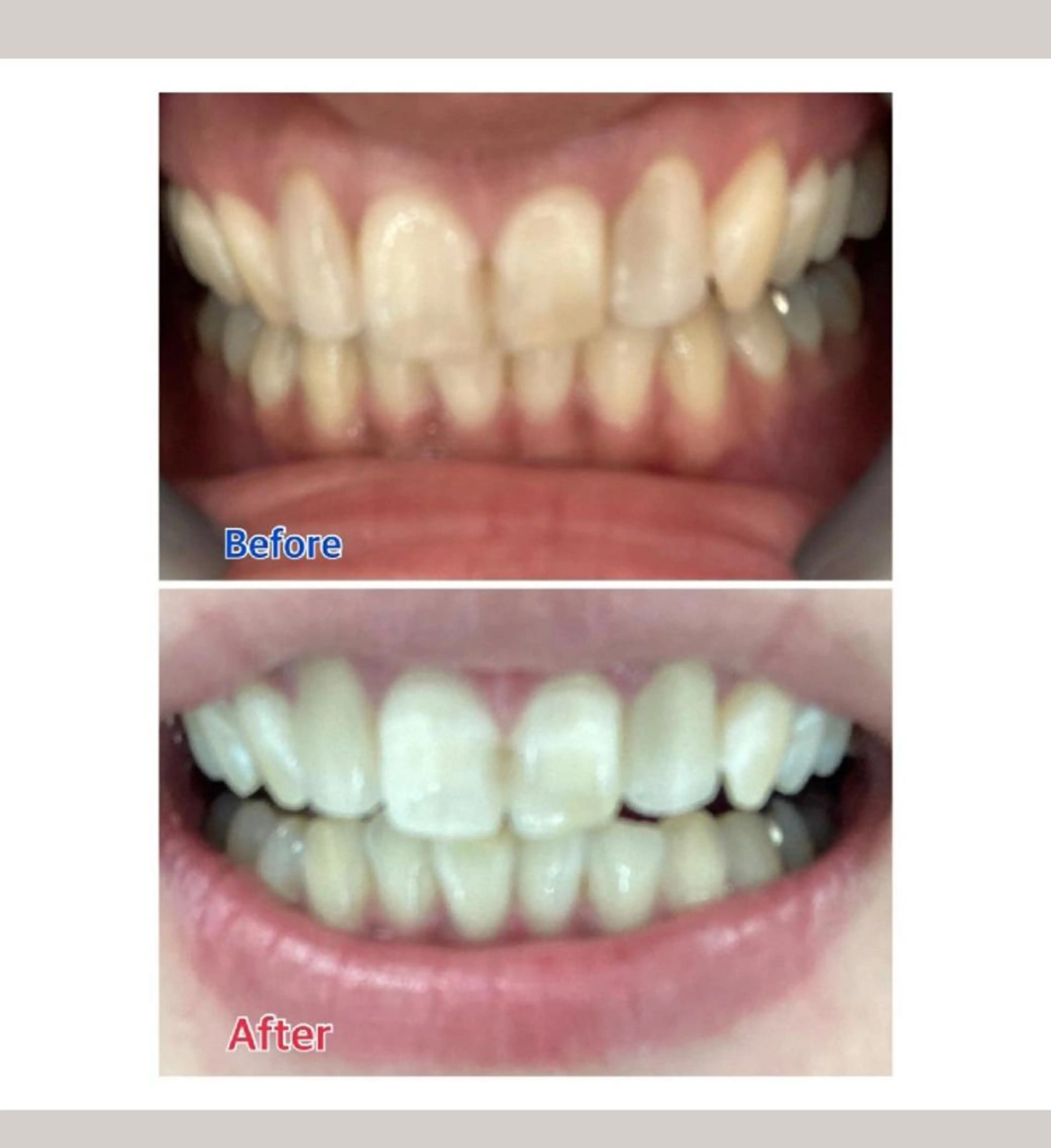 M渋谷店所属・M渋谷 ホワイトニングのエステ・リラクイメージ