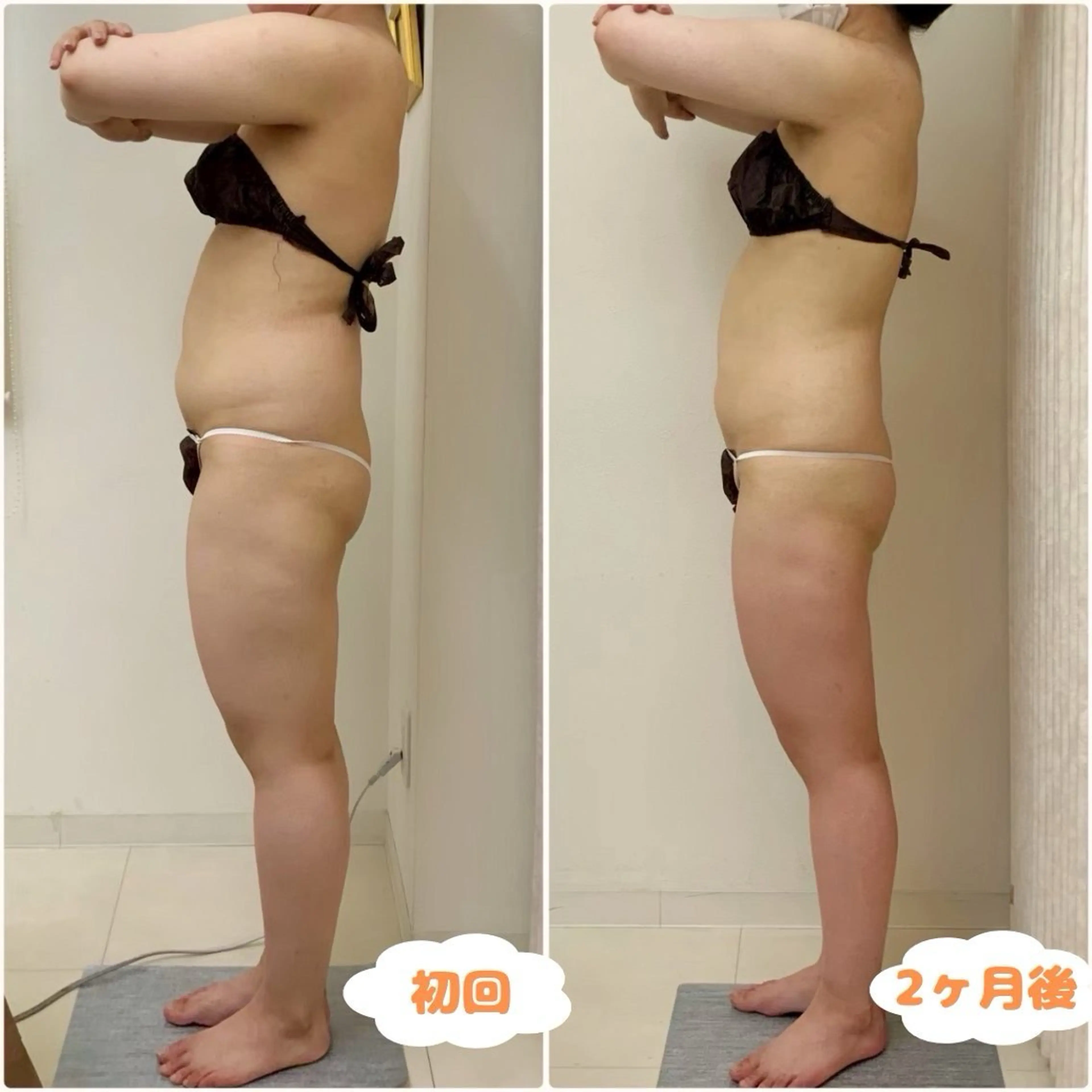 エステ 脱毛&美容サロン Dr.Epiのエステ・リラクイメージ