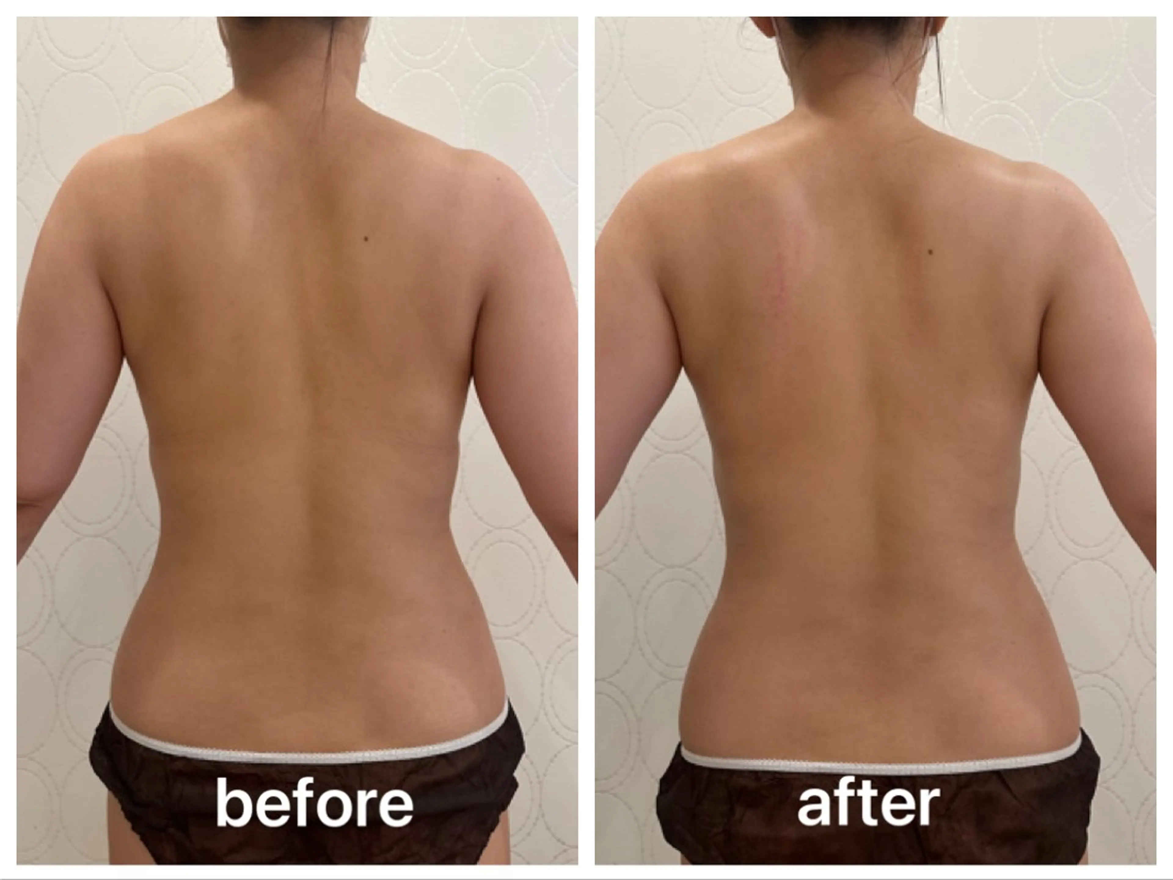 トータルビューティ サロンstageのエステ・リラクイメージ