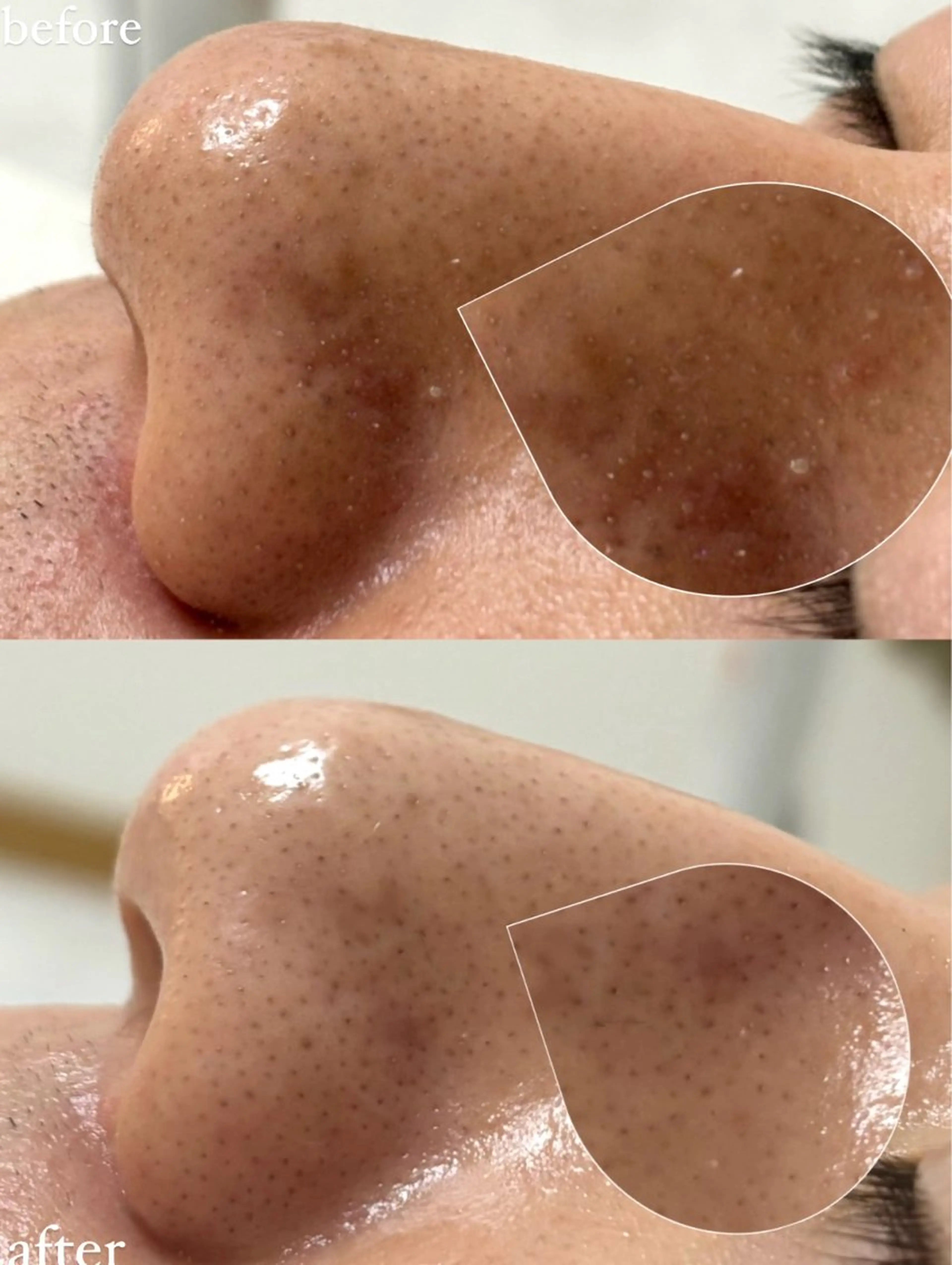 女性専門お顔剃り sunraineのエステ・リラクイメージ