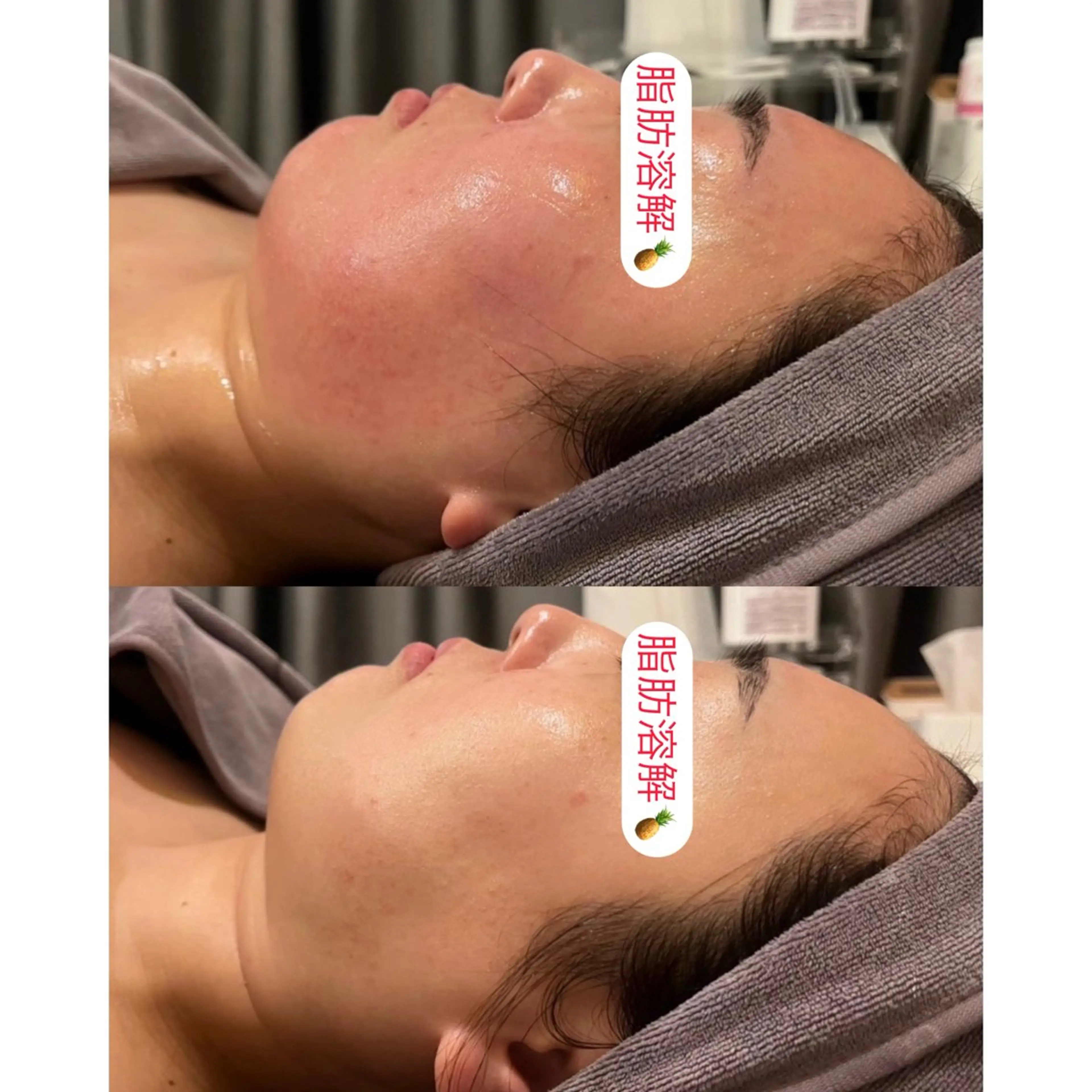 小顔コルギ ☆表参道/外苑前のエステ・リラクイメージ