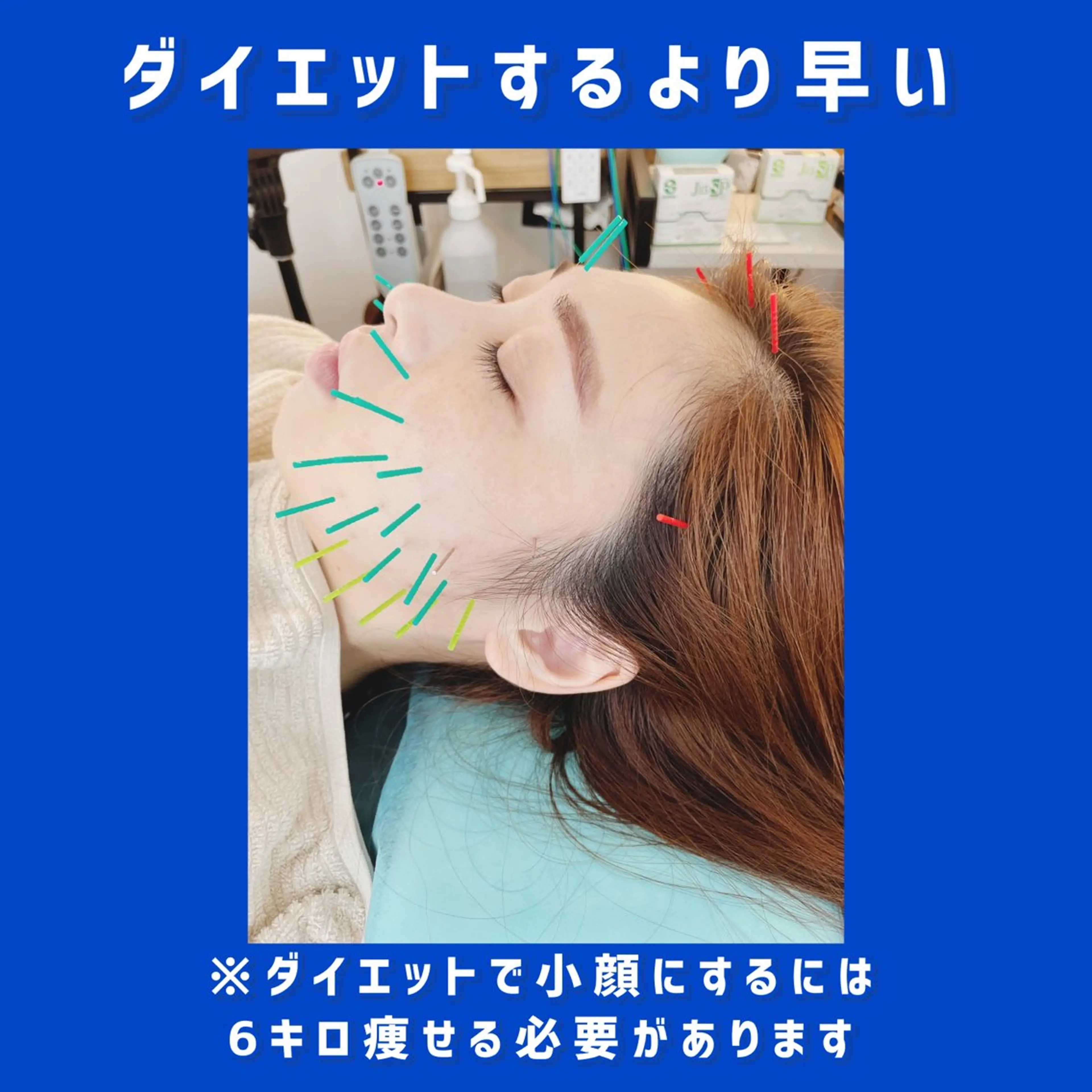 エステ リラク 小顔美容鍼専門サロン 渋谷YZのエステ・リラクイメージ