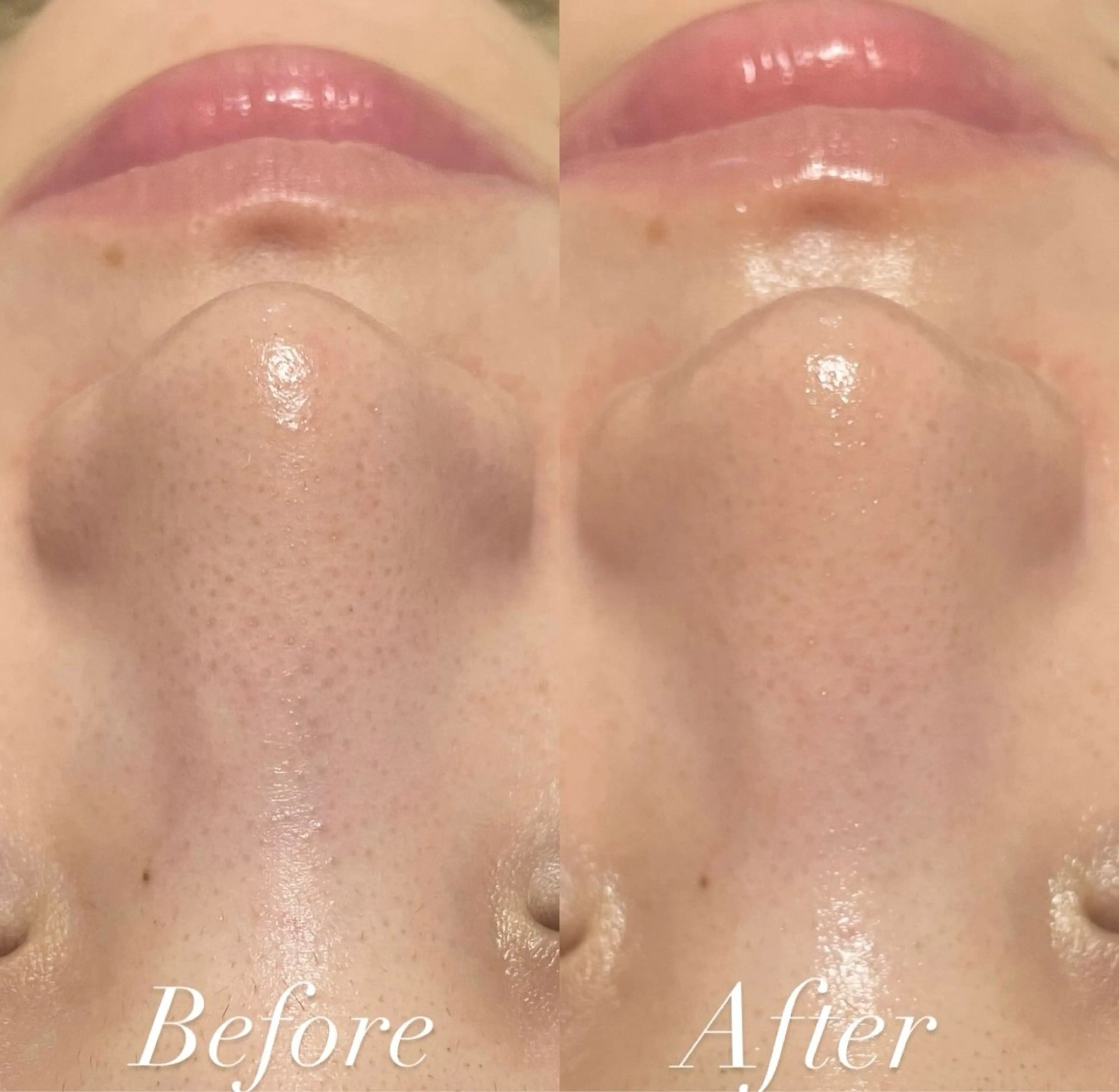 エステ リラク プライベートサロン Belle（ベル）のエステ・リラクイメージ