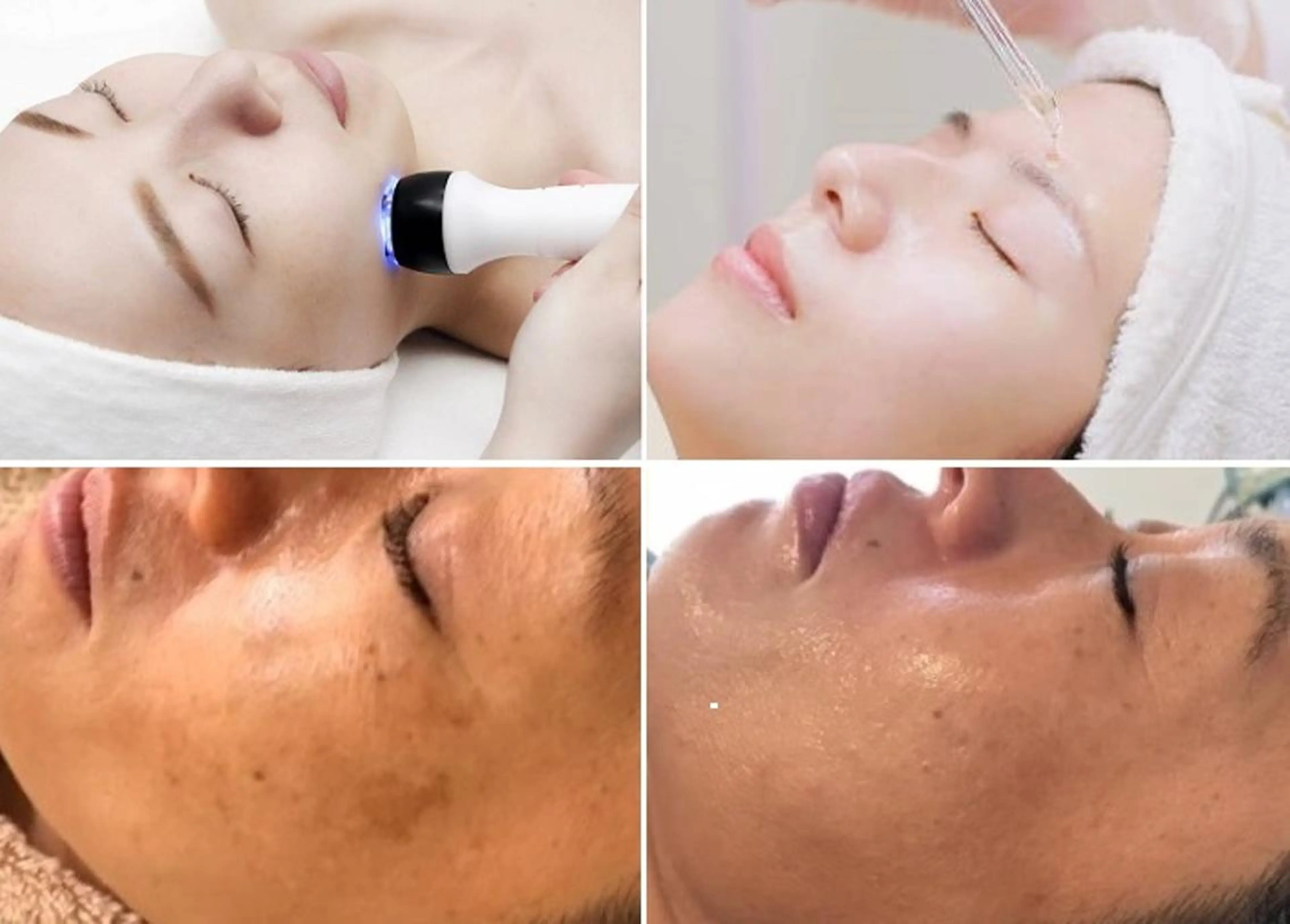 エステ 顔脱毛＆毛穴＆ニキビ 優良№1♪ヒロコ♪のエステ・リラクイメージ