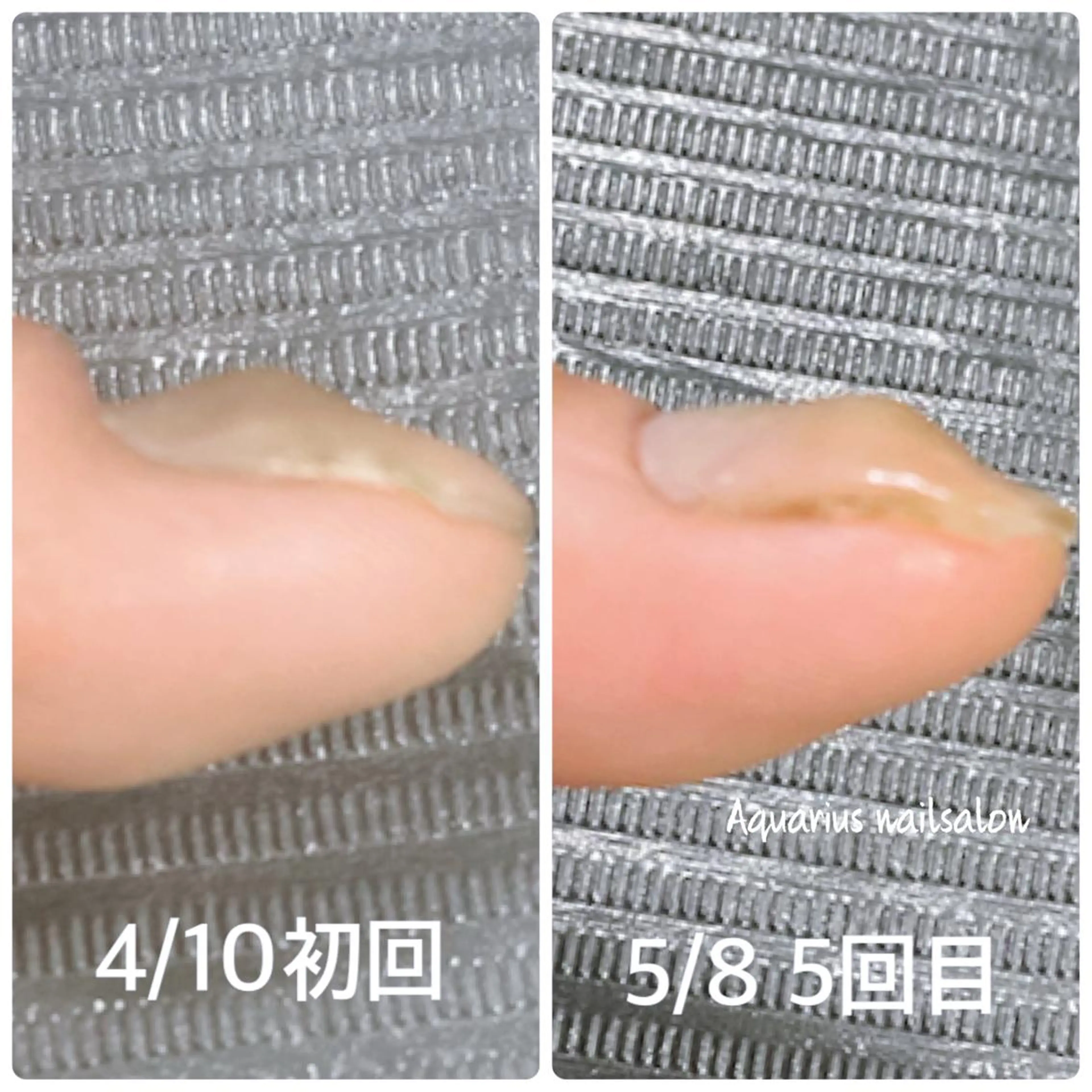 ネイル 奥園 良恵のネイルデザイン