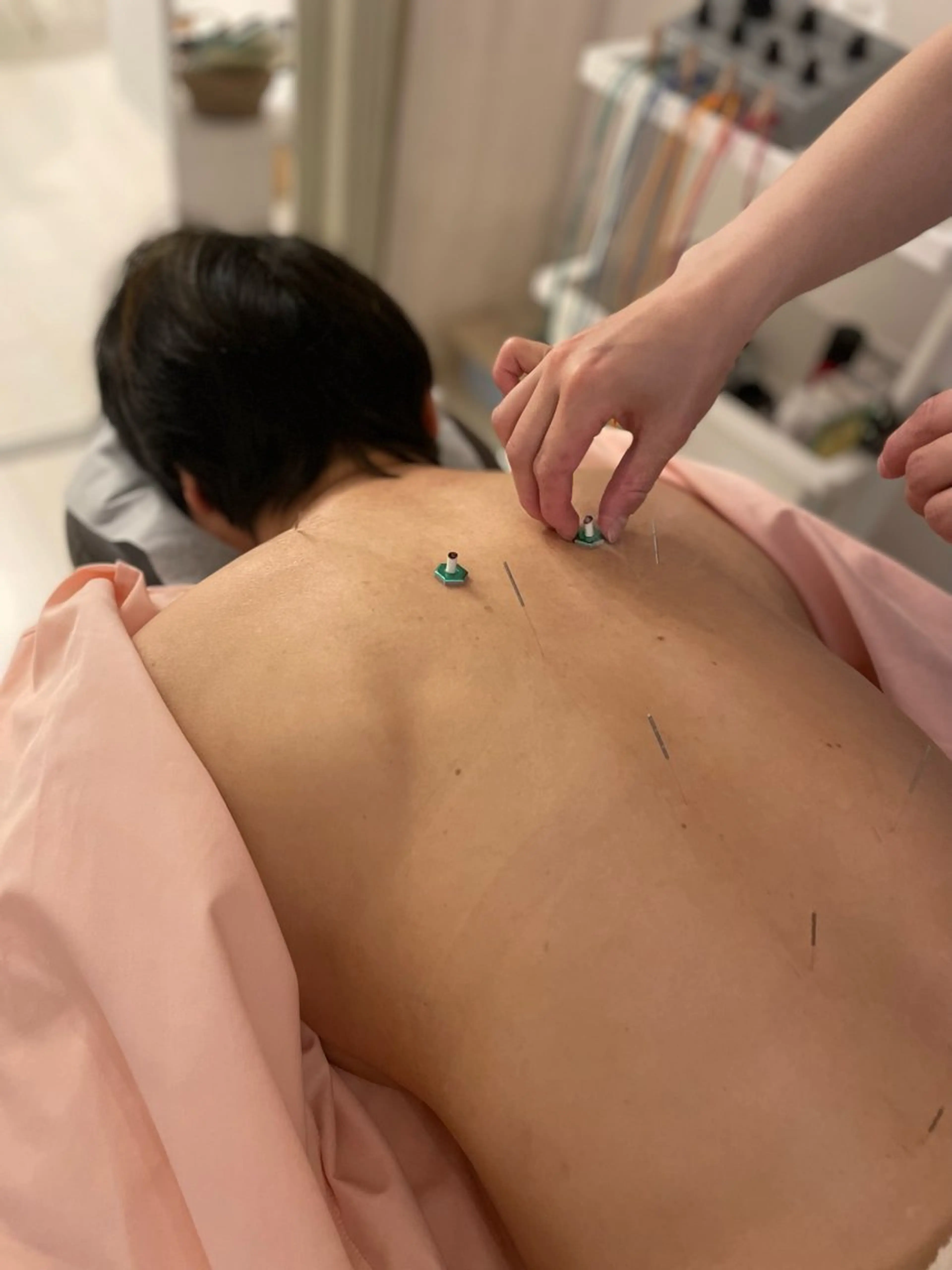 美容鍼灸サロン   colorier所属・美容鍼灸サロン colorierのエステ・リラクイメージ