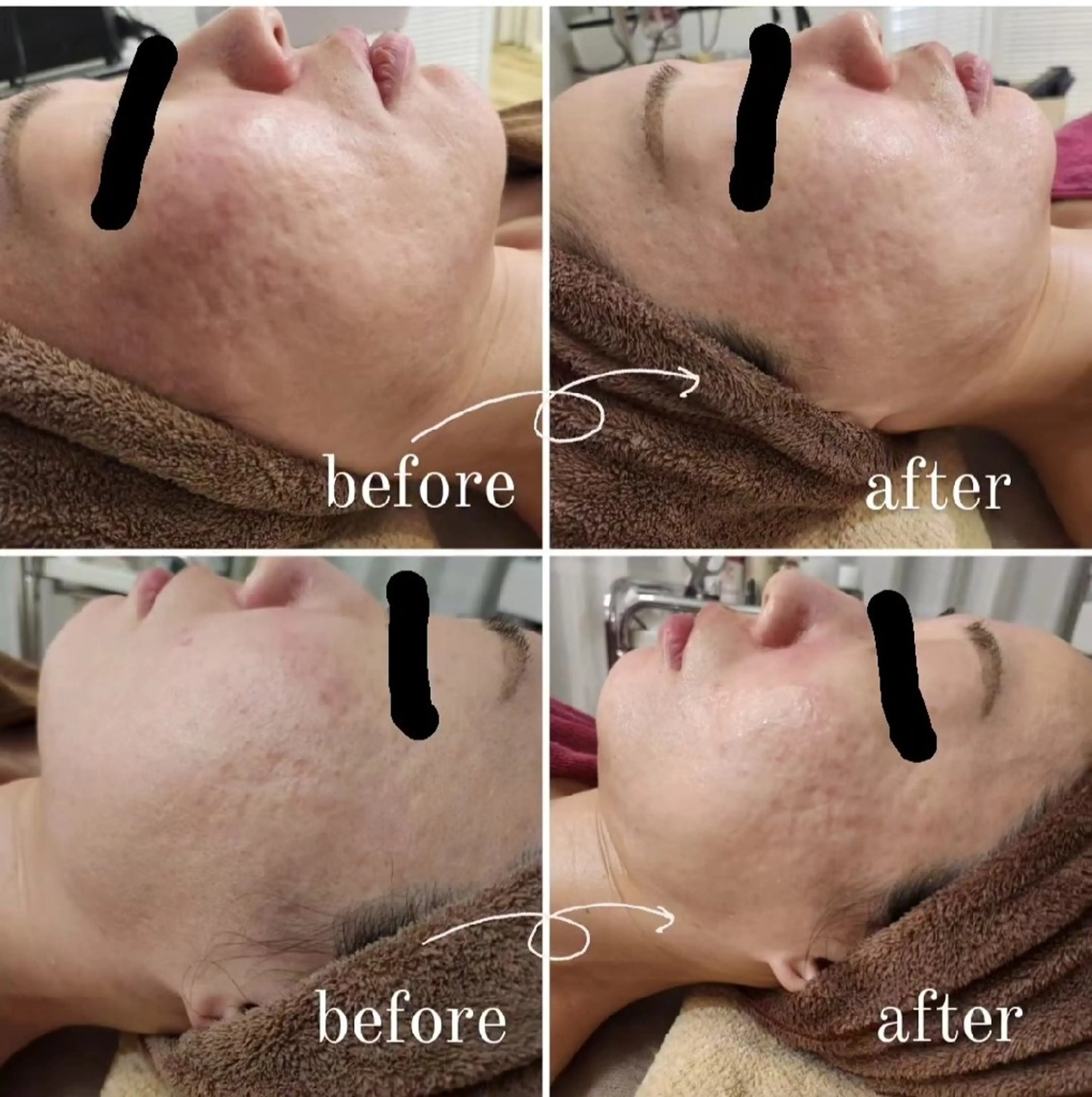 エステ Anacia Beauty Salon所属・美肌脱毛&毛穴専門 Anaciaのエステ・リラクイメージ