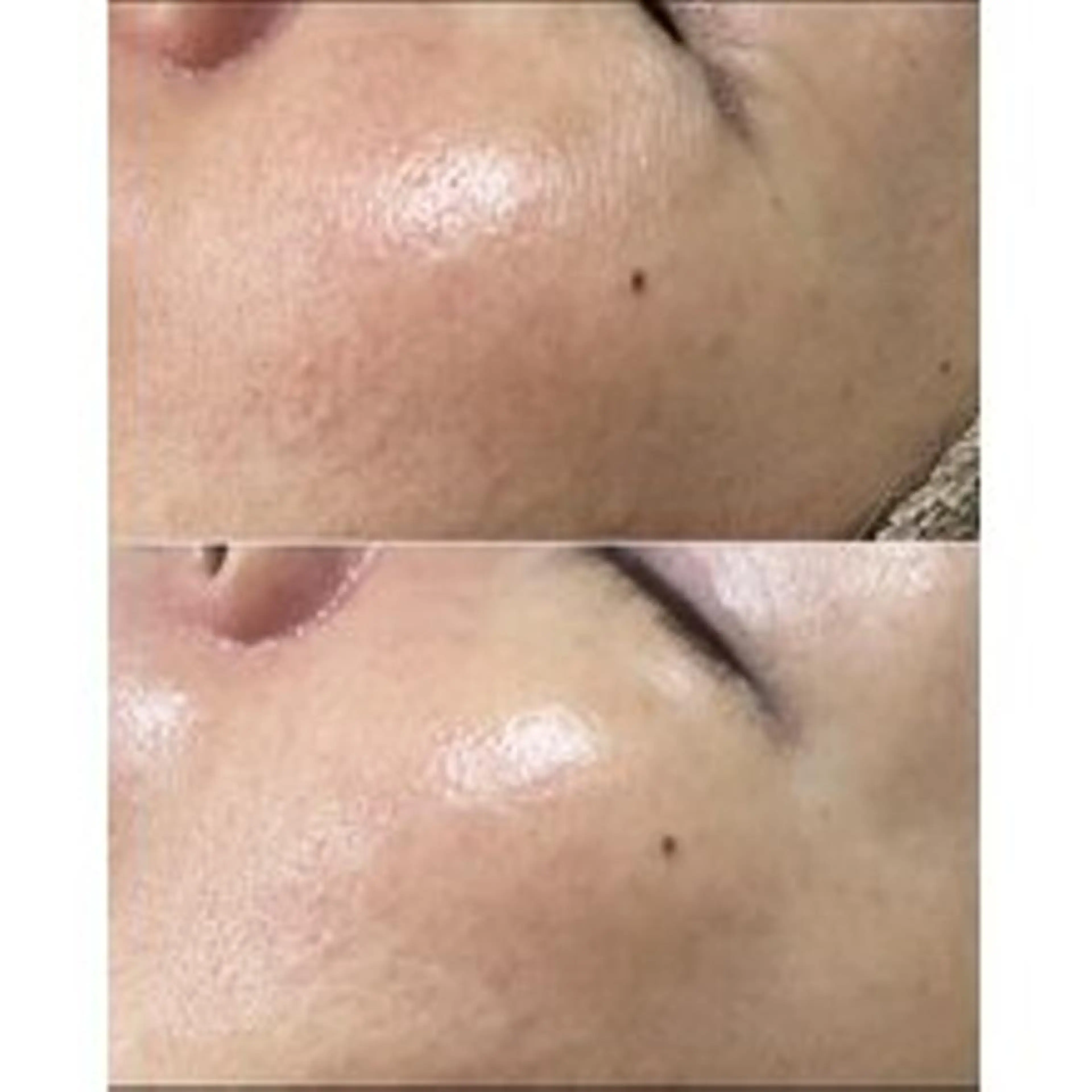 エステ リラク トラブル肌専門店 プレイス天王寺店のエステ・リラクイメージ