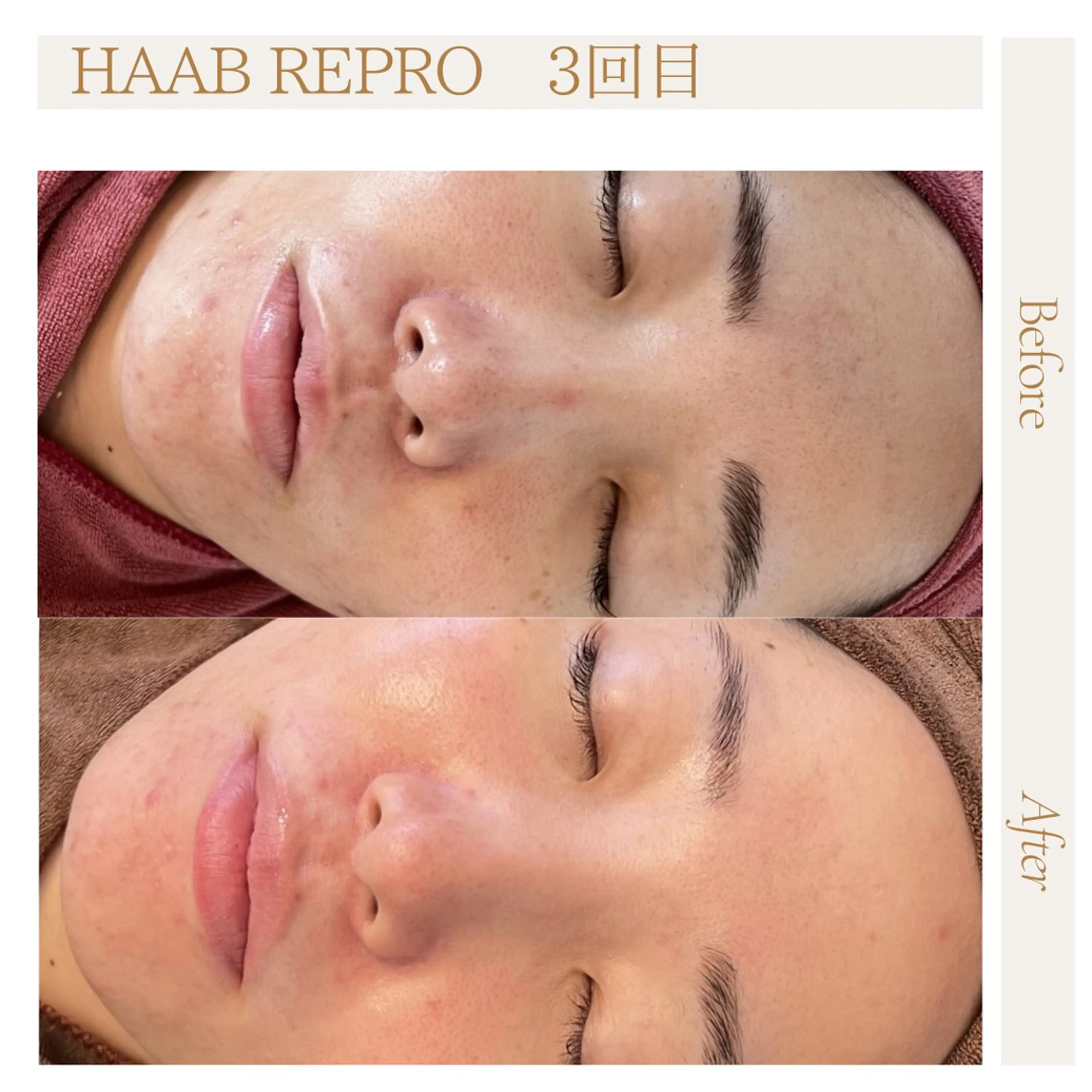 肌管理サロン neoriiのその他イメージ