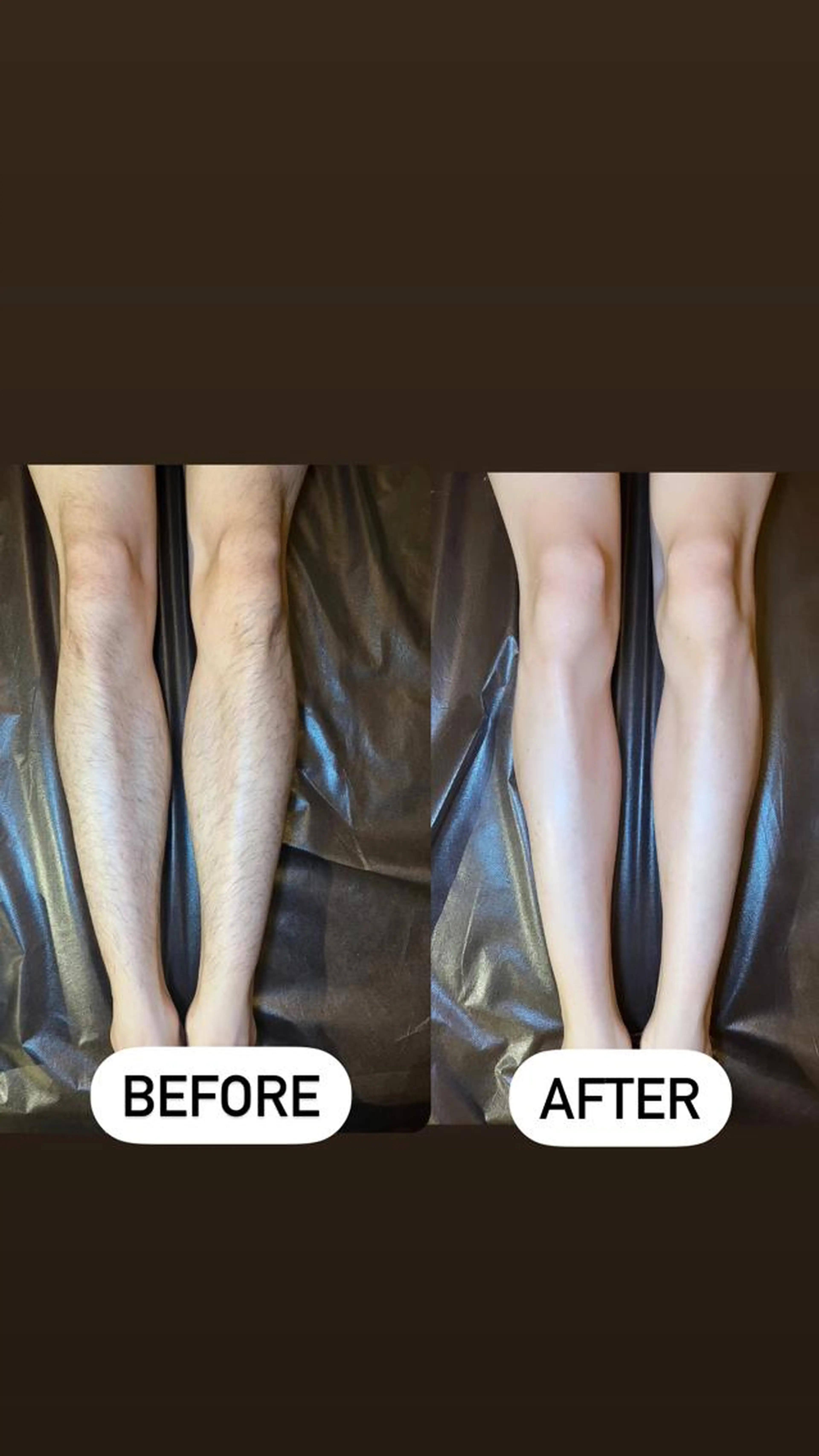 ✨メンズ✨両脚　ワックス脱毛　太ももから下￥11000✨の写真