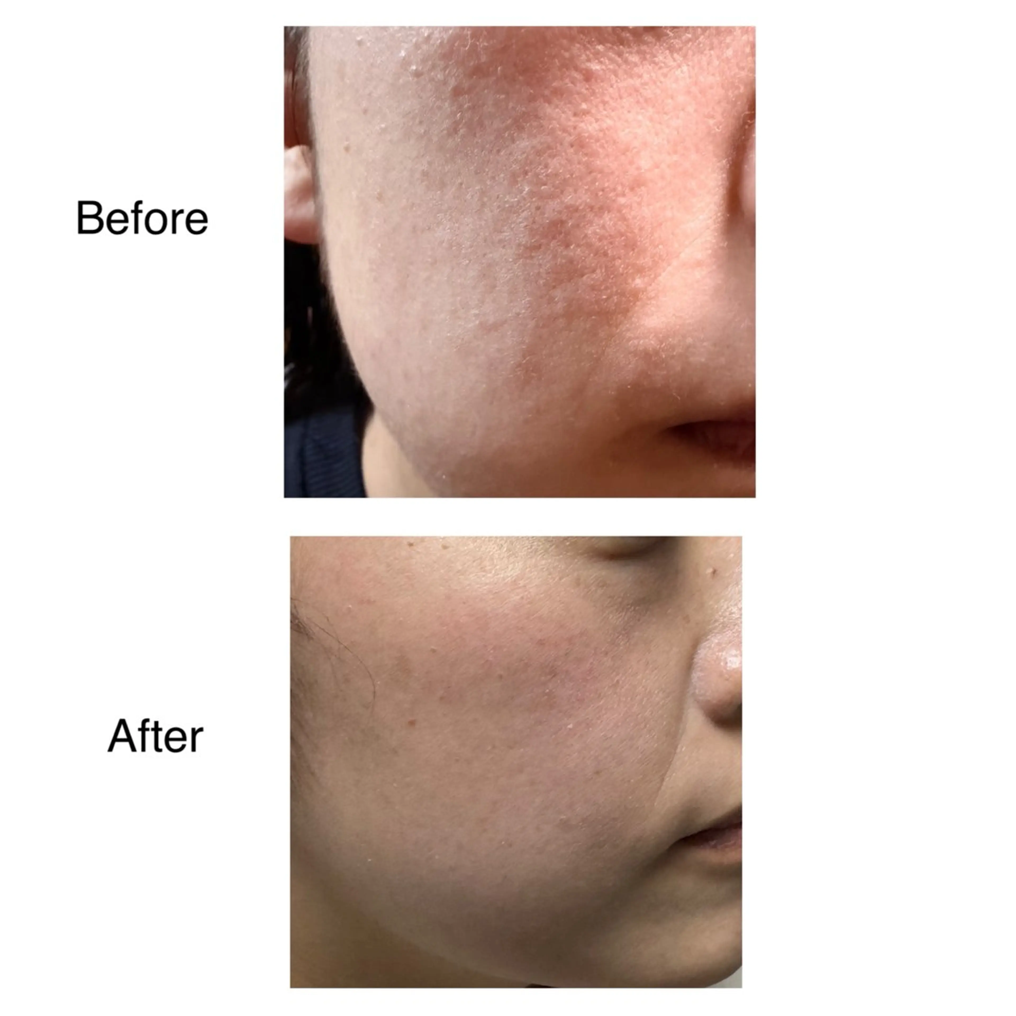 エステ ROR所属・ROR nailのエステ・リラクイメージ