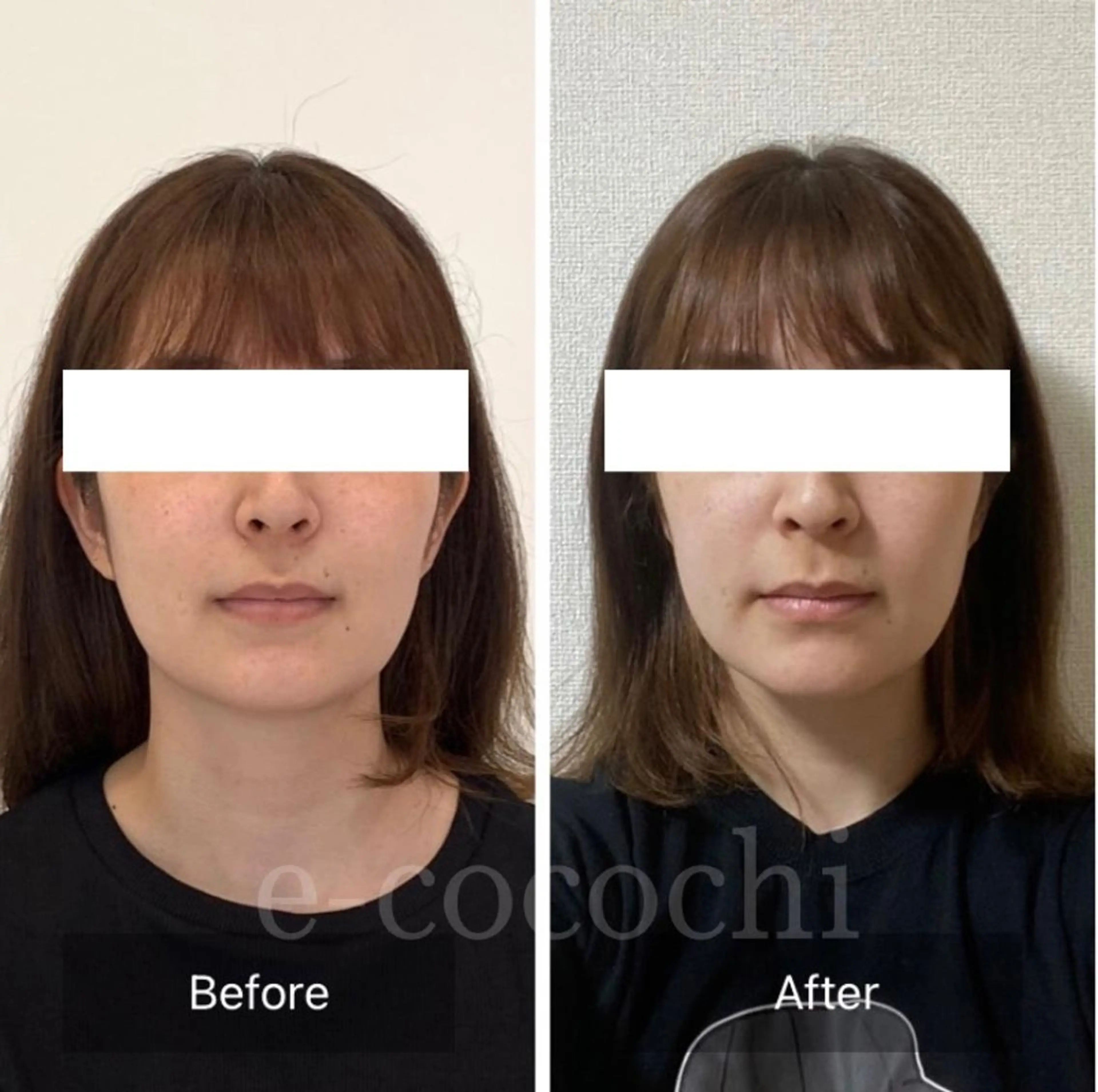 エステ リラク 小顔と ヘッドスパのお店のエステ・リラクイメージ