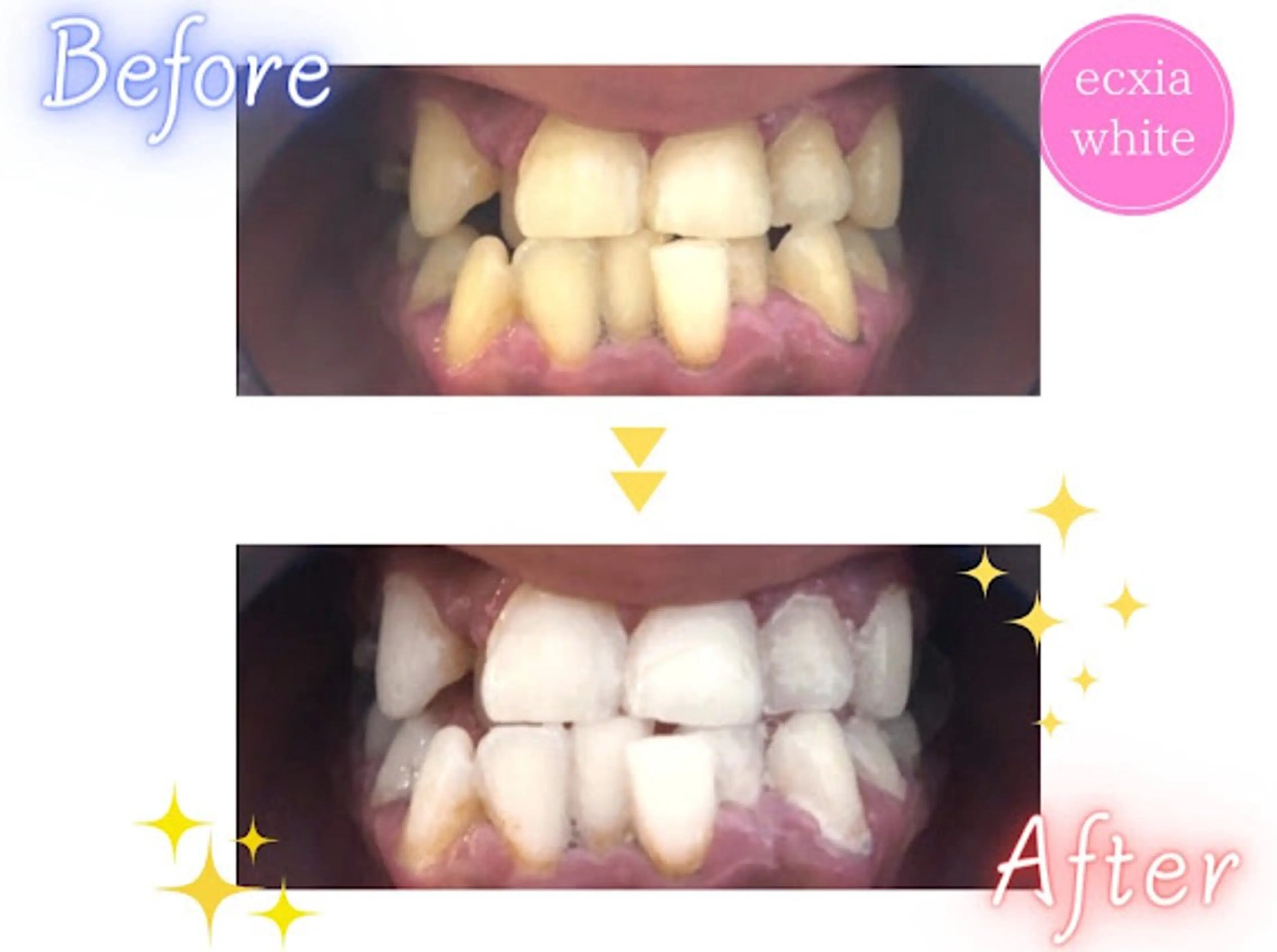 ecxia  white 　広島袋町店所属・セルフホワイトニング エクシア広島袋町店のその他イメージ