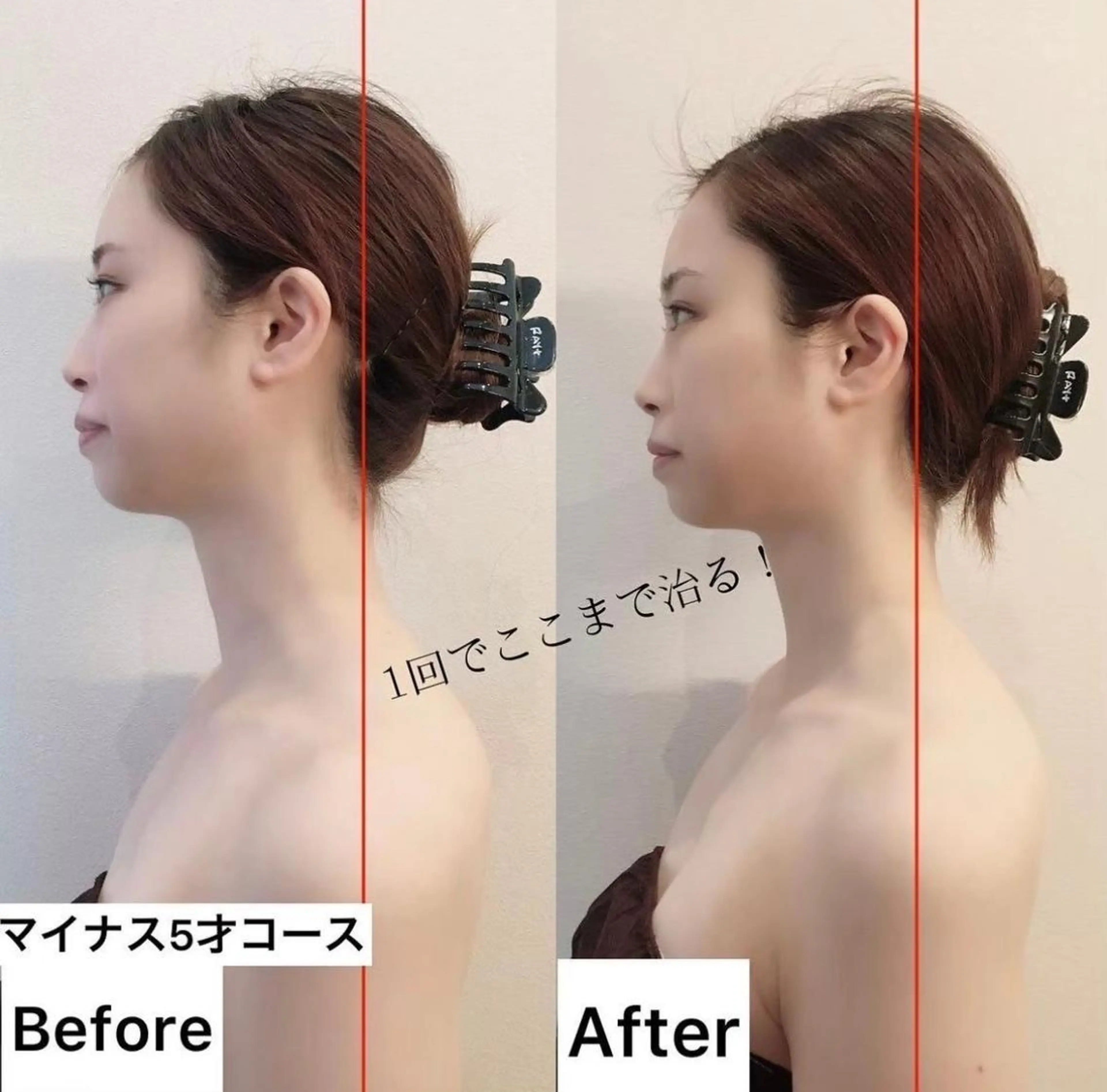 【10月限定】糸を使わないフェイスリフト★4Dパルスフェイシャル[60分]の写真