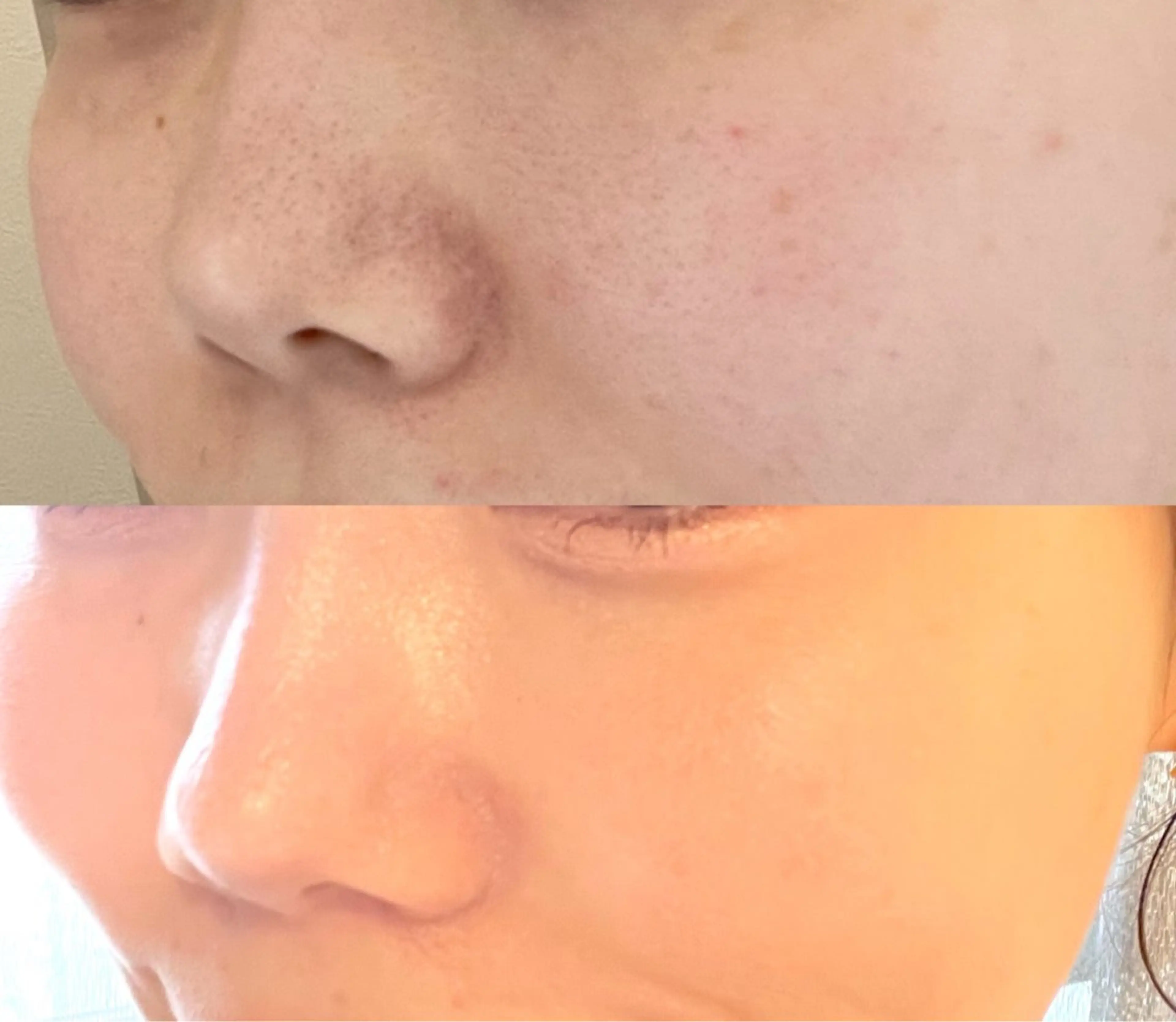 エステ 小顔/たるみ/黒ずみ除去専門サロン/SONA 大和西大寺店所属・【小顔専門看護師 サロンSONA】のエステ・リラクイメージ