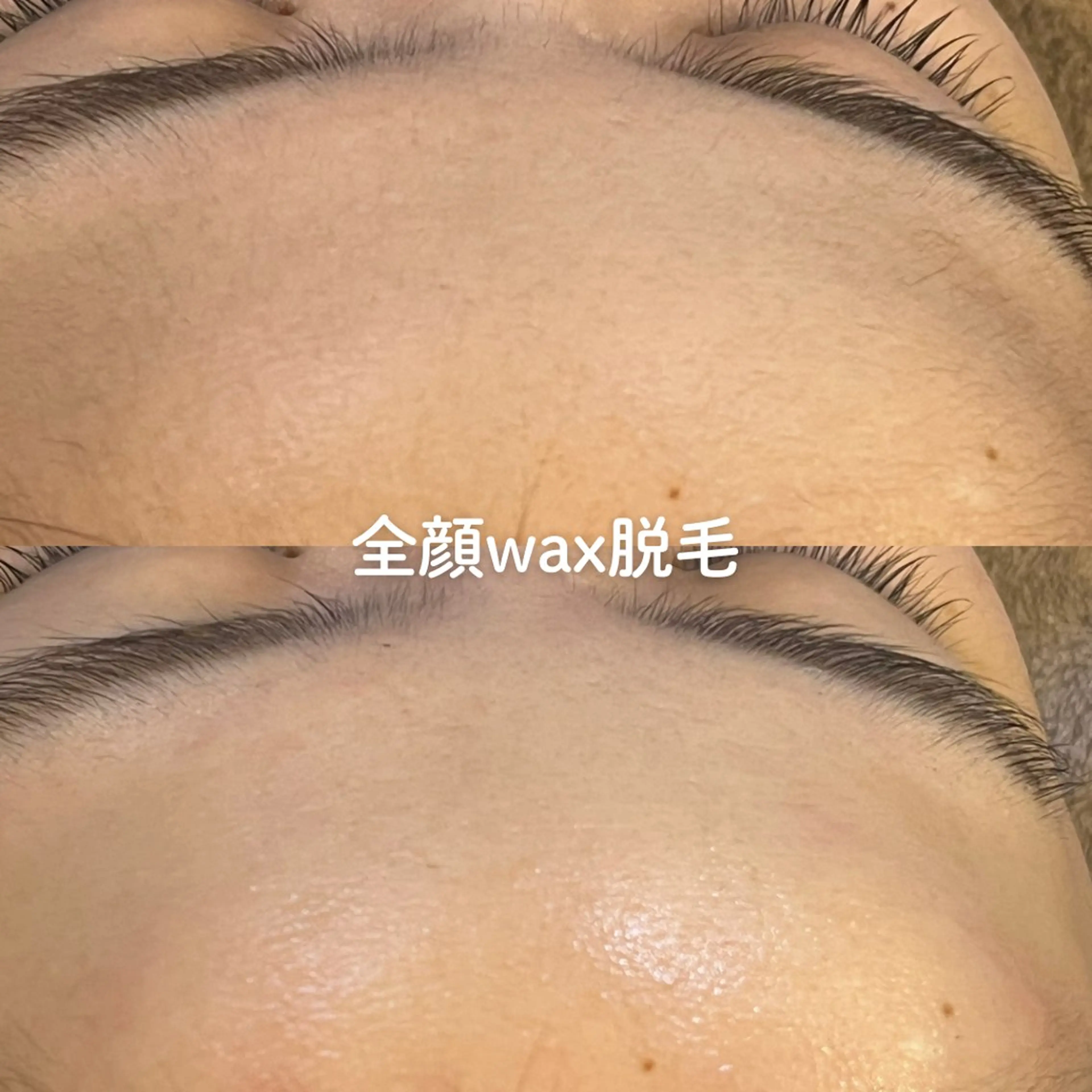 EST BEAUTY所属・顔ワックス脱毛/ ハーブピーリングのエステ・リラクイメージ