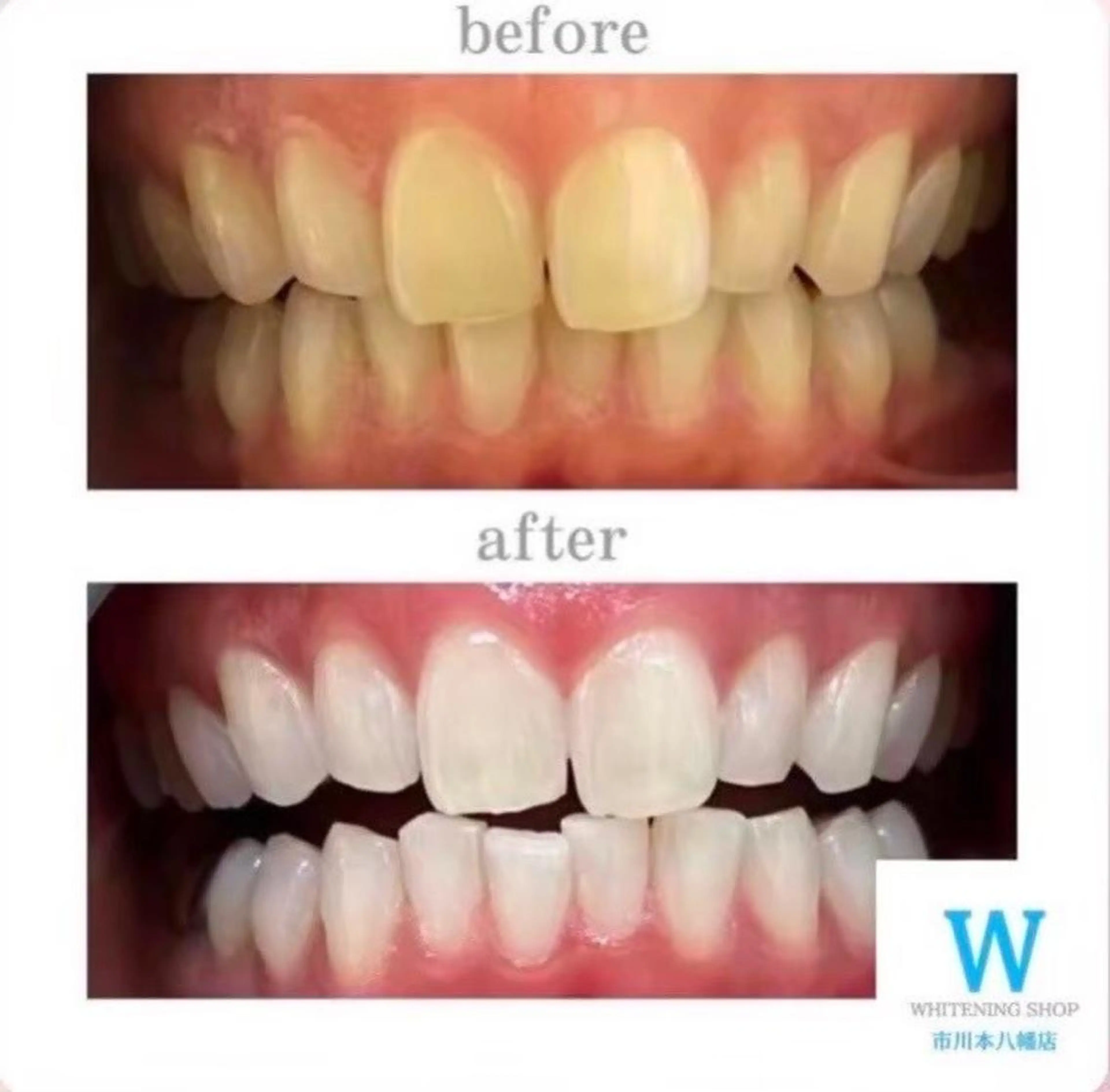 ホワイトニング ショップ本八幡店のエステ・リラクイメージ