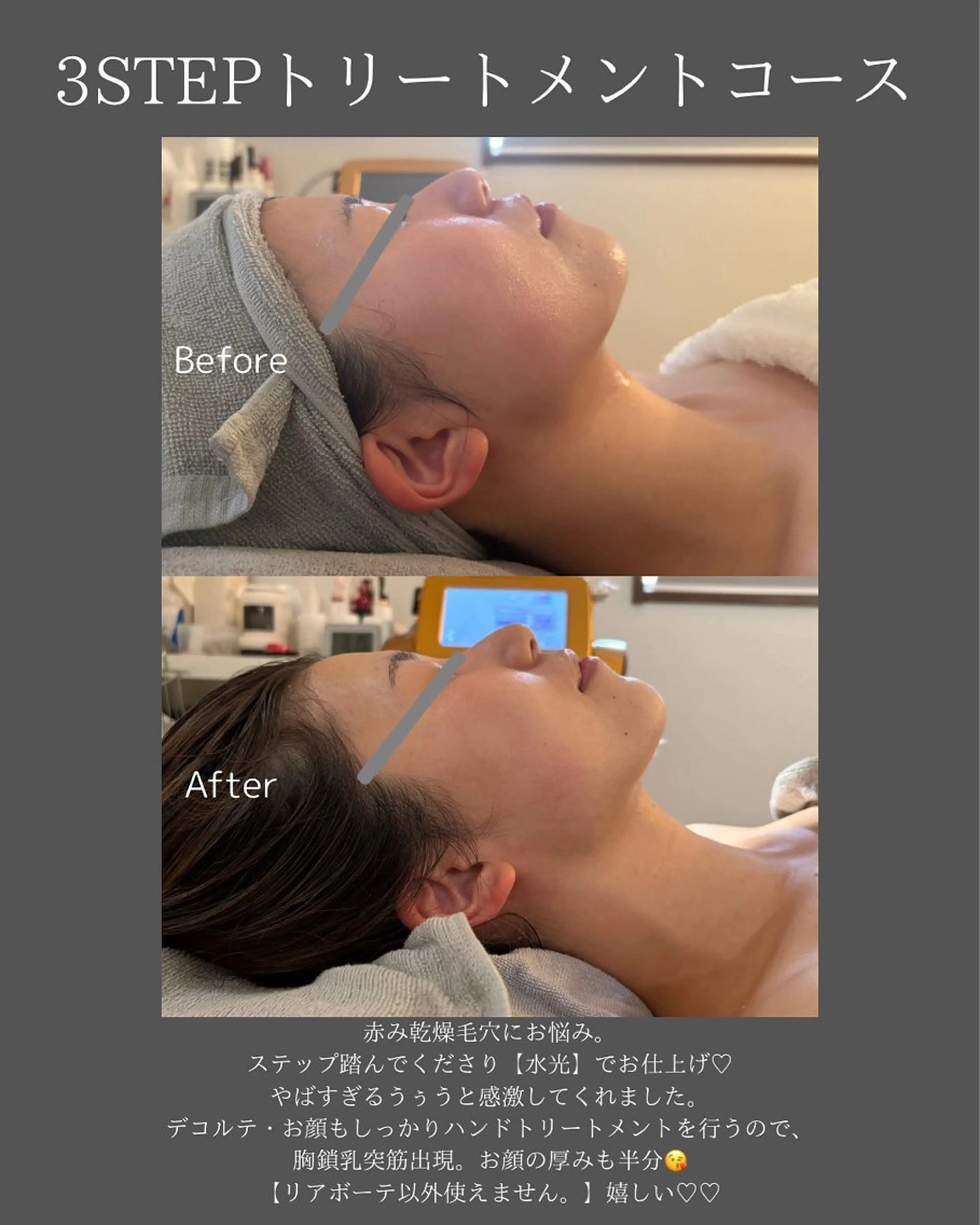 エステ BLOSSOM 菊地のエステ・リラクイメージ