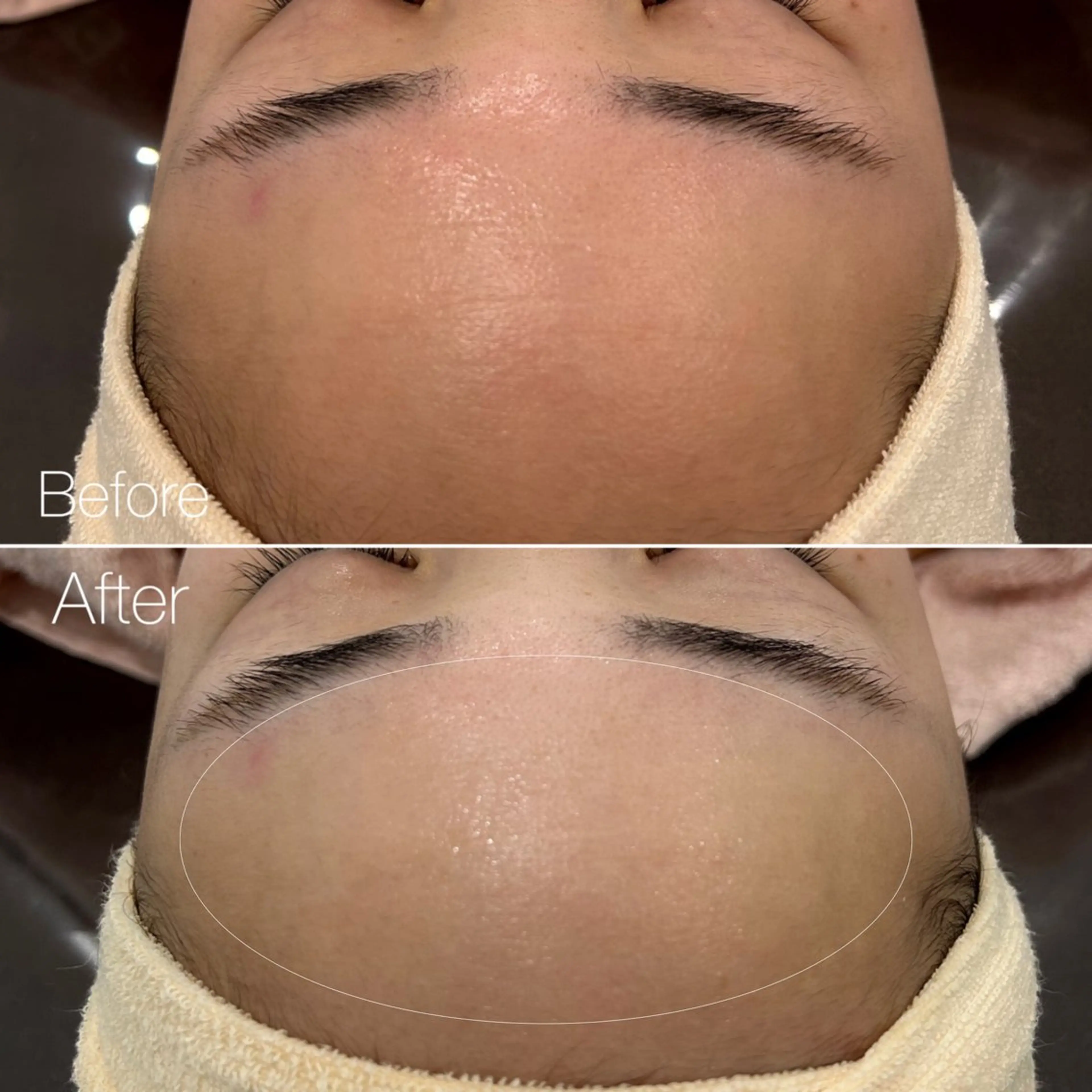 〈etre〉トータルビューティーサロン所属・etre - 韓国肌管理 -のエステ・リラクイメージ