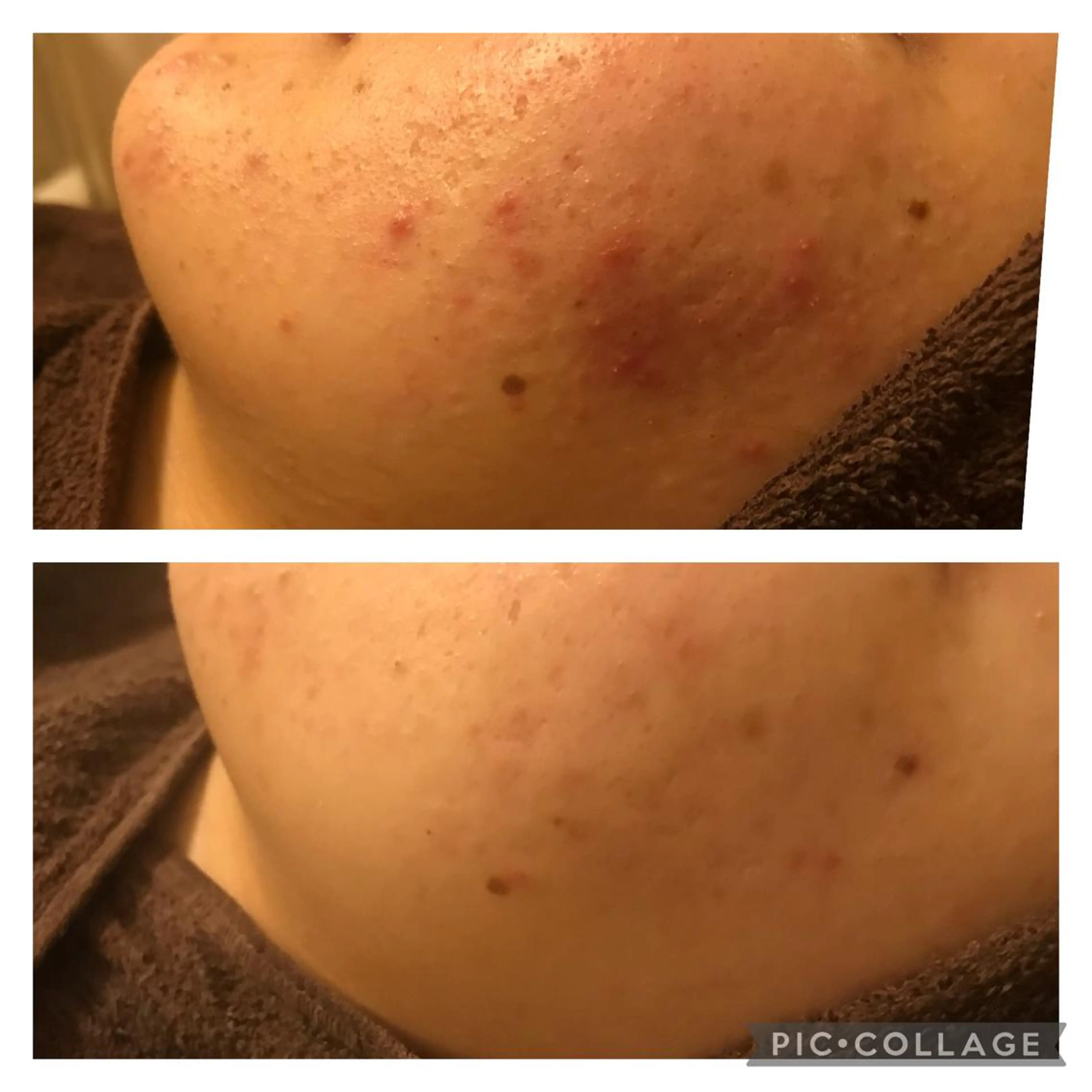 ミディアム カラー パーマ ヘアアレンジ メンズ キッズ マツエク・マツパ アニメ,Vオタク× 即効痩せエステサロンのエステ・リラクイメージ