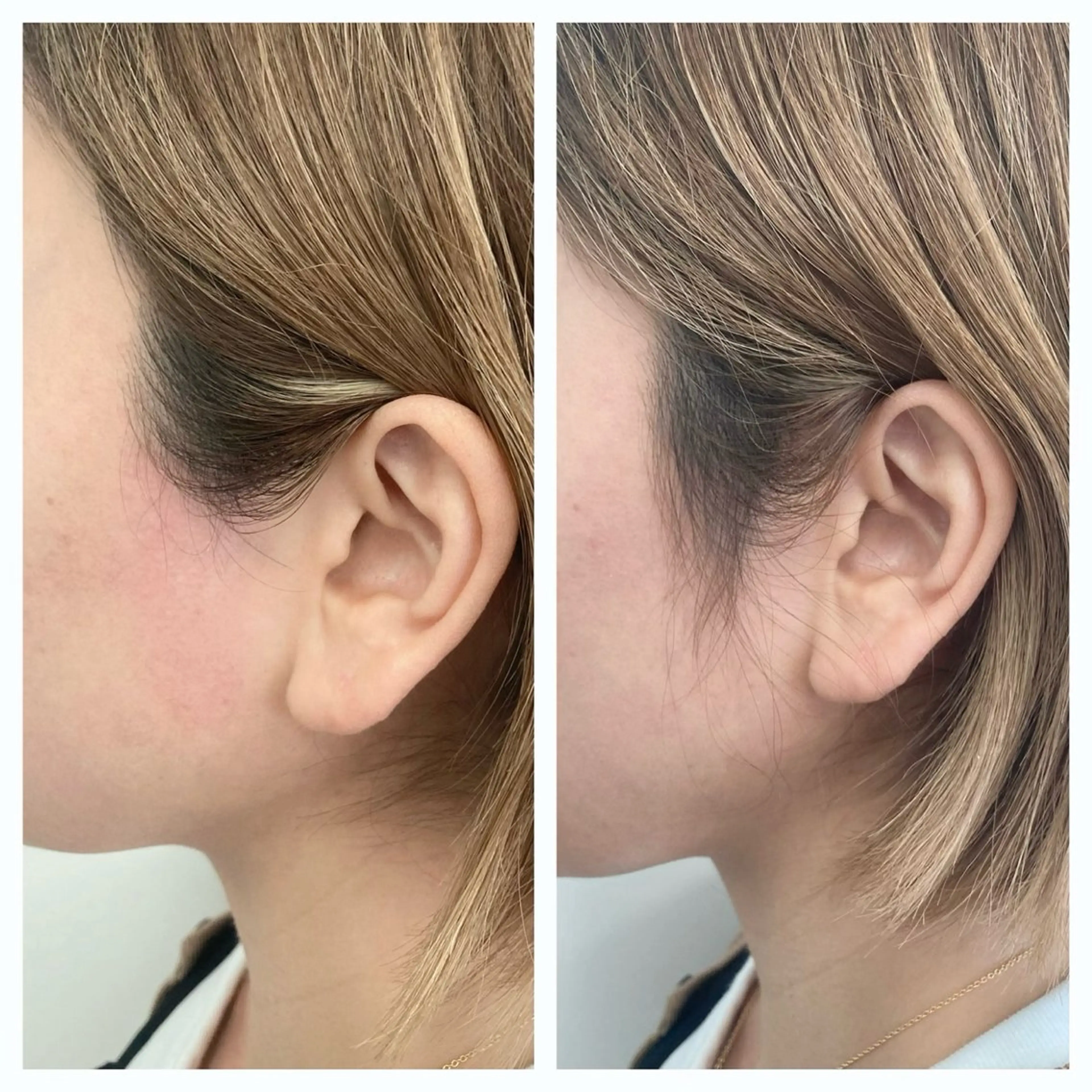 その他 meow by hug.所属・恵比寿🌻ワックス 顔うなじVIOワキのエステ・リラクイメージ